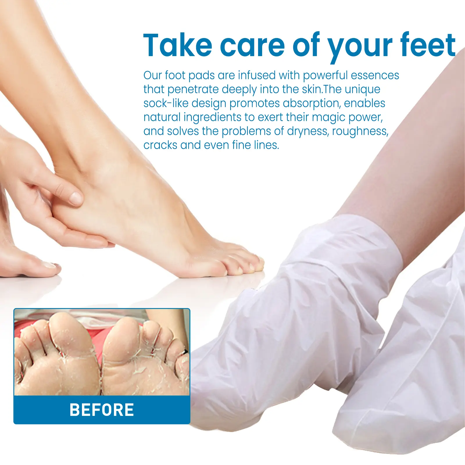 Exfoliating Foot Pads for Callus Removal & Moisturizing 3D Mask - West&Month 4 3d foot pad exfoliate clean anti chap moisturize West Month 373 5873