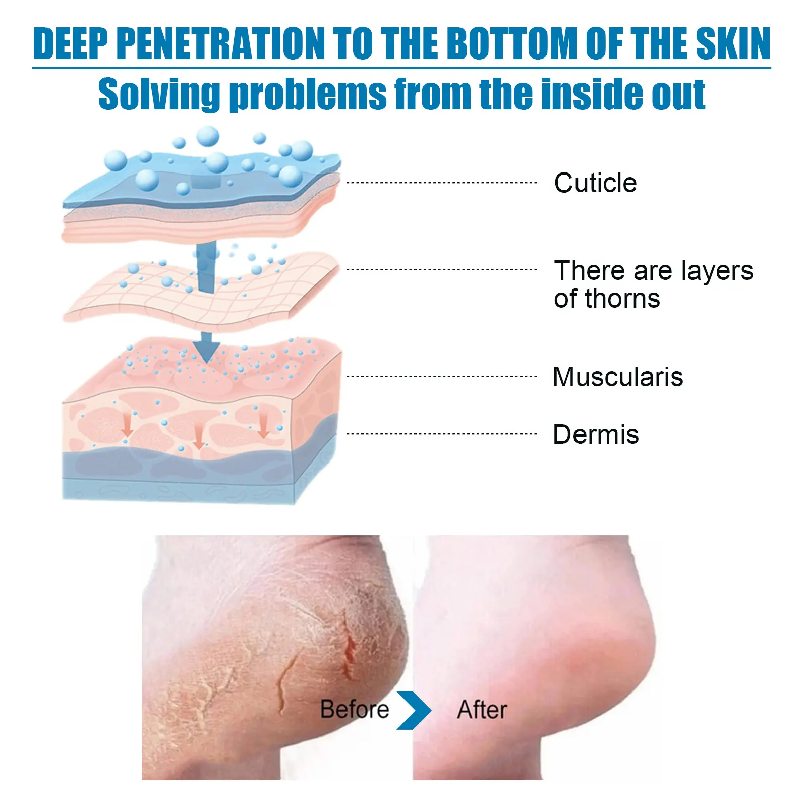 Exfoliating Foot Pads for Callus Removal & Moisturizing 3D Mask - West&Month 5 3d foot pad exfoliate clean anti chap moisturize West Month 373 5874