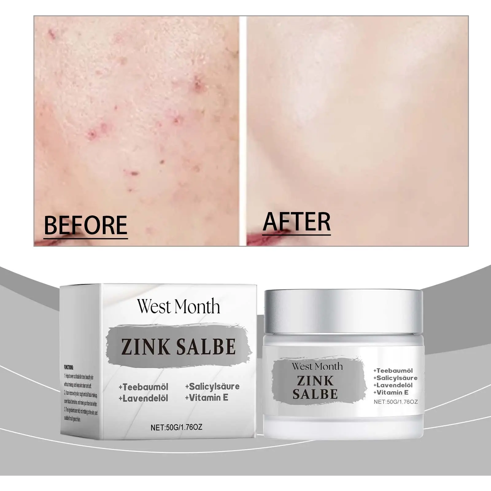 Acne Face Cream with Oil Control & Soothing Formula - West&Month 2 acne cream refresh oil control repair soothe West Month 471 7229