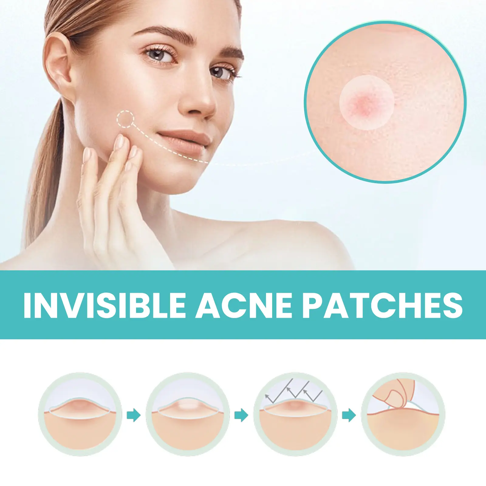 Acne Patches for Blackheads (240 Count) Discreet & Waterproof - West&Month 6 acne patch 300pcs repair invisible breathable West Month 647 9371