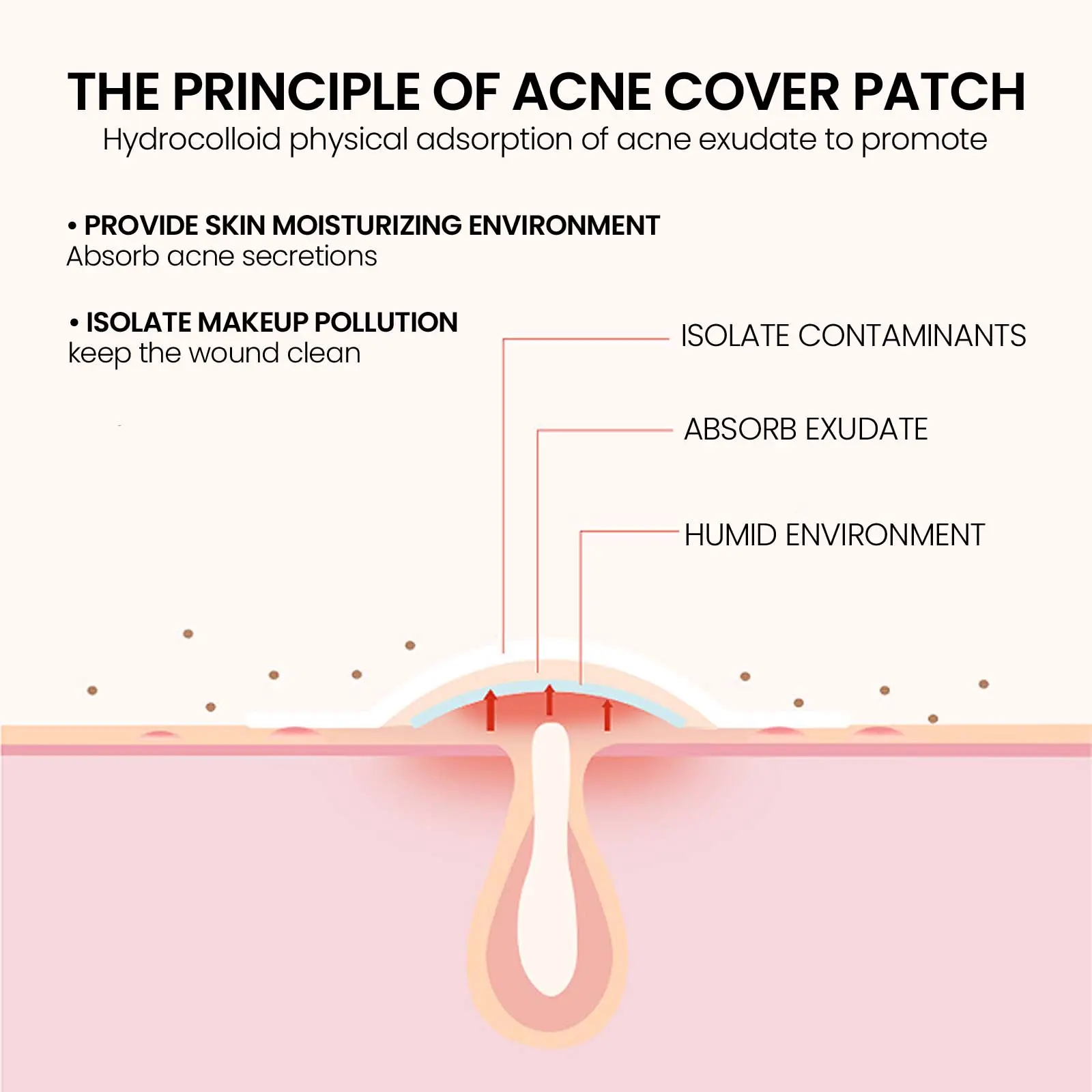 Acne Patches for Closed Comedones Breathable Skin Smoothing Treatment West 6 acne patch repair closed mouth breathable West Month 168 3215