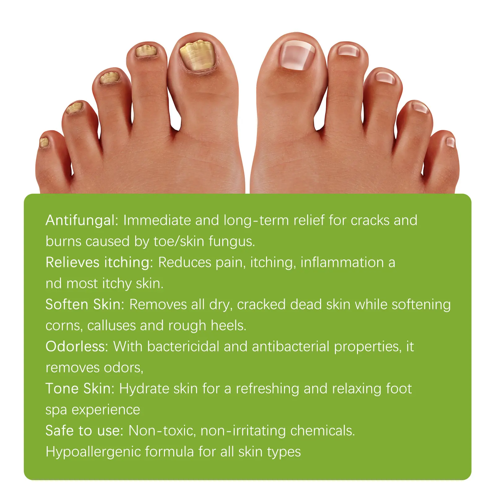 Anti-fungal Foot Soak Tablets for Nail Repair & Smooth Skin - West&Month 3 anti fungal foot soak repair gray nail deodorize West Month 435 6730