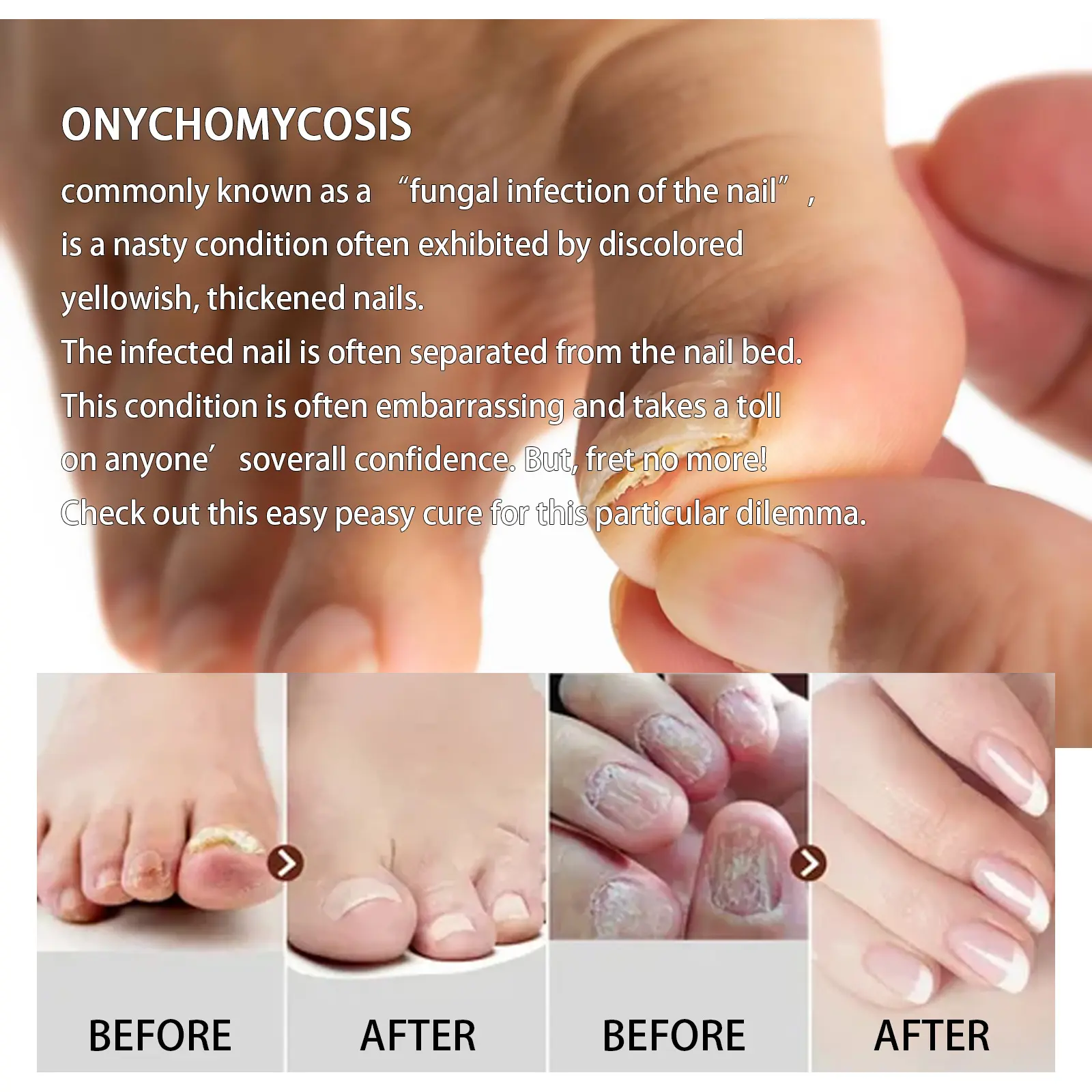Anti-fungal Foot Soak Tablets for Nail Repair & Smooth Skin - West&Month 4 anti fungal foot soak repair gray nail deodorize West Month 435 6731