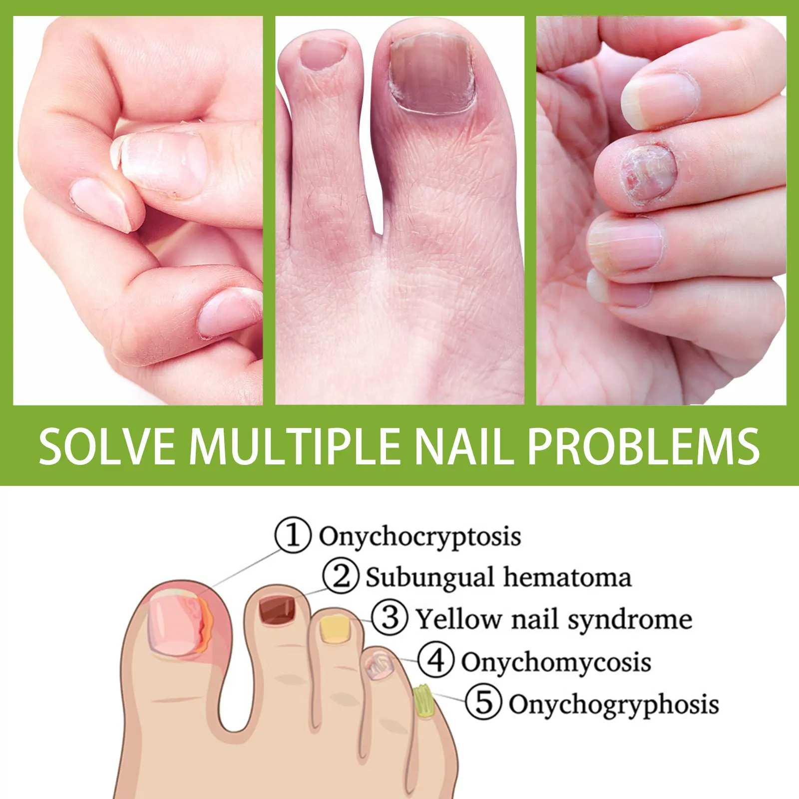 Anti-fungal Foot Soak Tablets for Nail Repair & Smooth Skin - West&Month 5 anti fungal foot soak repair gray nail deodorize West Month 435 6732