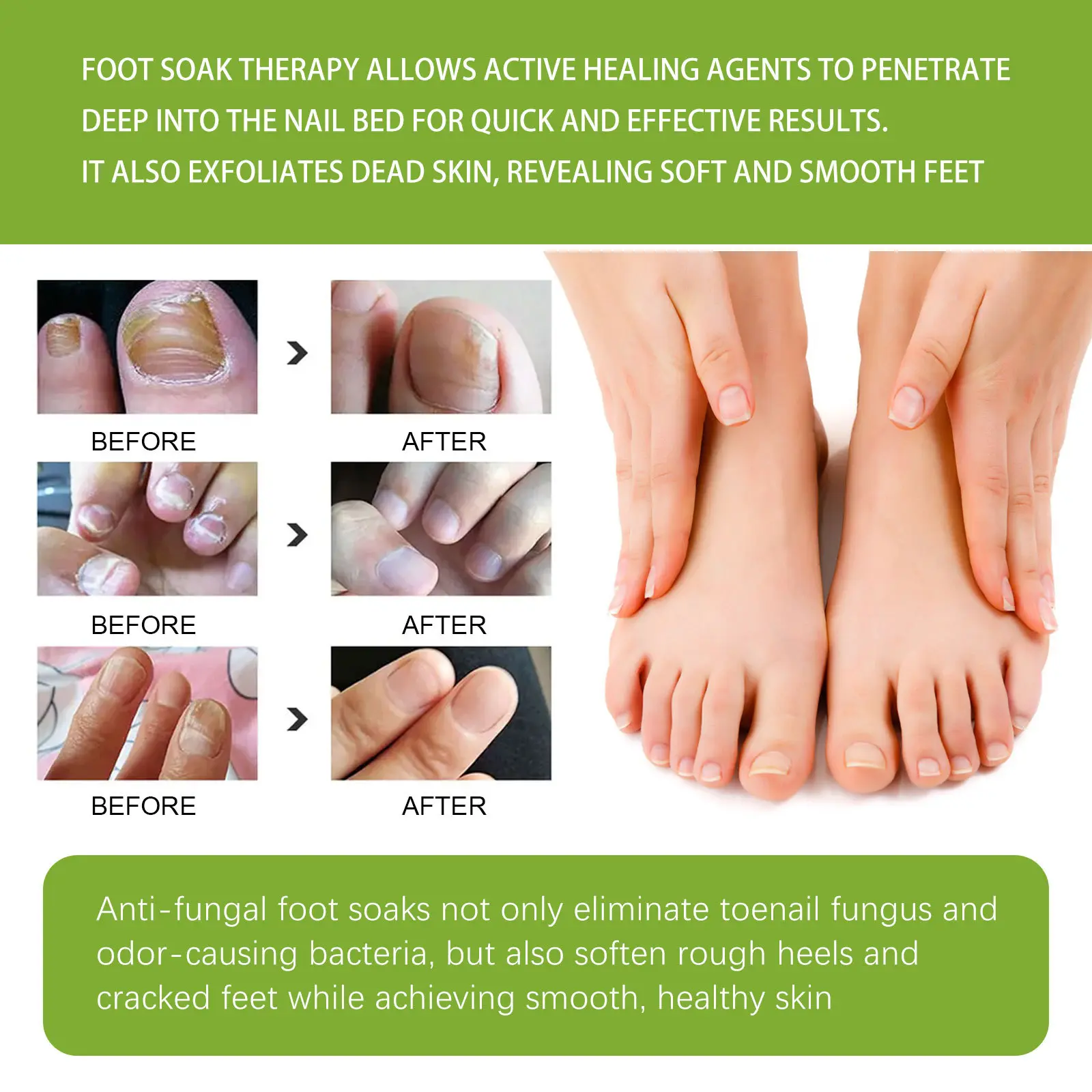 Anti-fungal Foot Soak Tablets for Nail Repair & Smooth Skin - West&Month 7 anti fungal foot soak repair gray nail deodorize West Month 435 6734
