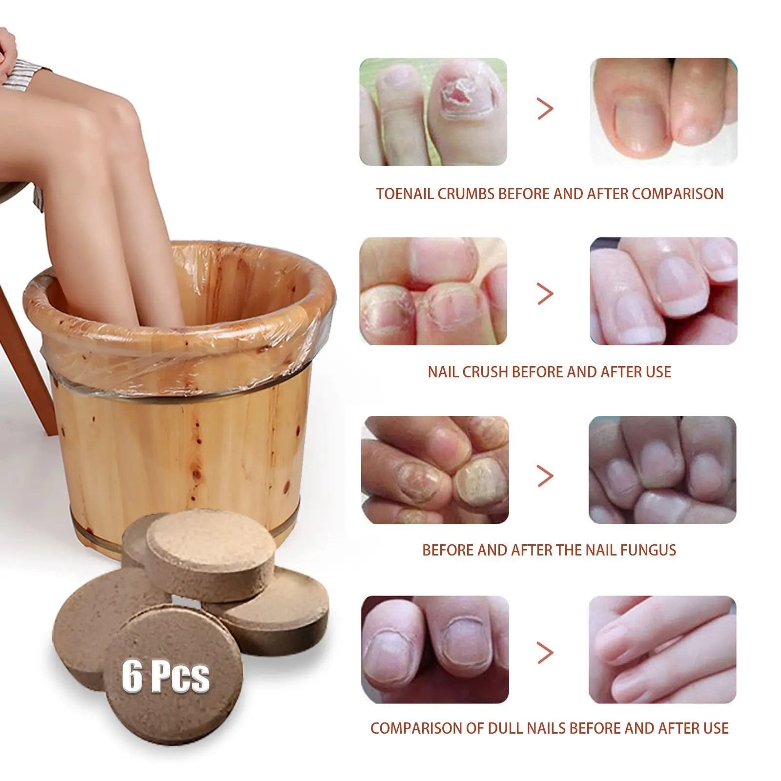 Anti-fungal Foot Soak Tablets for Nail Repair & Smooth Skin - West&Month 8 anti fungal foot soak repair gray nail deodorize West Month 435 6735