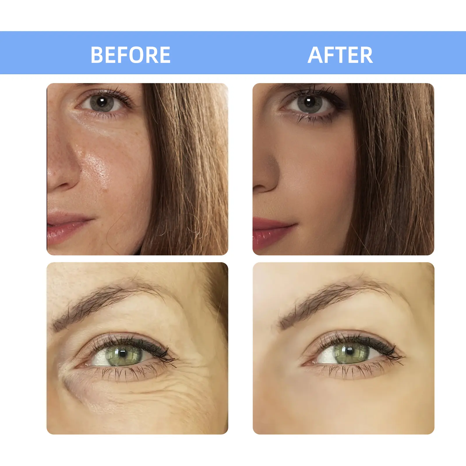 Anti-Wrinkle Energy Ampoule for Firming & Fine Lines - West&Month 9 anti wrinkle ampoule reduce lines revitalize tighten West Month 402 6278