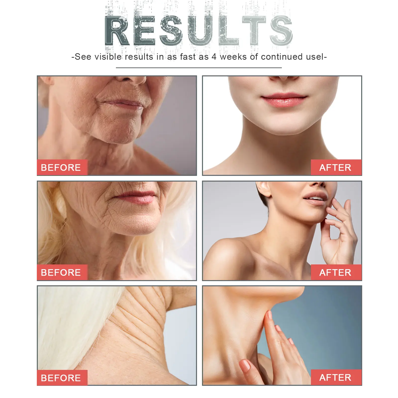 Anti-Wrinkle Firming Moisturizing Spray for Neck and Body - West&Month 9 anti wrinkle spray firm tender neck line West Month 342 5439