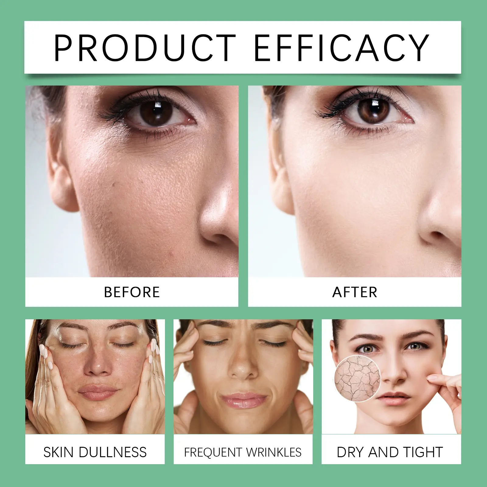 Azelaic Acid Essence Cream Brightening & Oil Control - West&Month 9 azelaic acid essence cream repair oil control West Month 077 2065