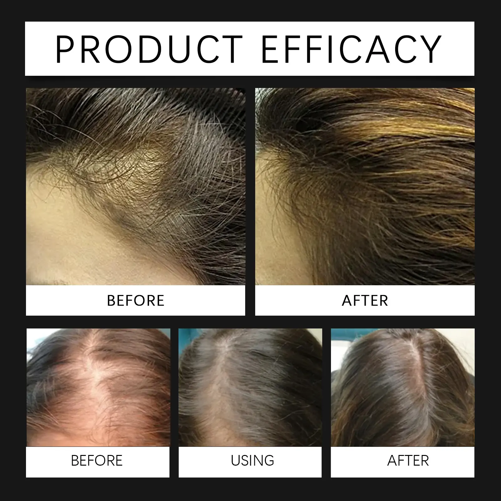Batana Hair Oil for Softening and Hydration - West&Month 9 batana hair oil soften nourish hydrate West Month 473 7265