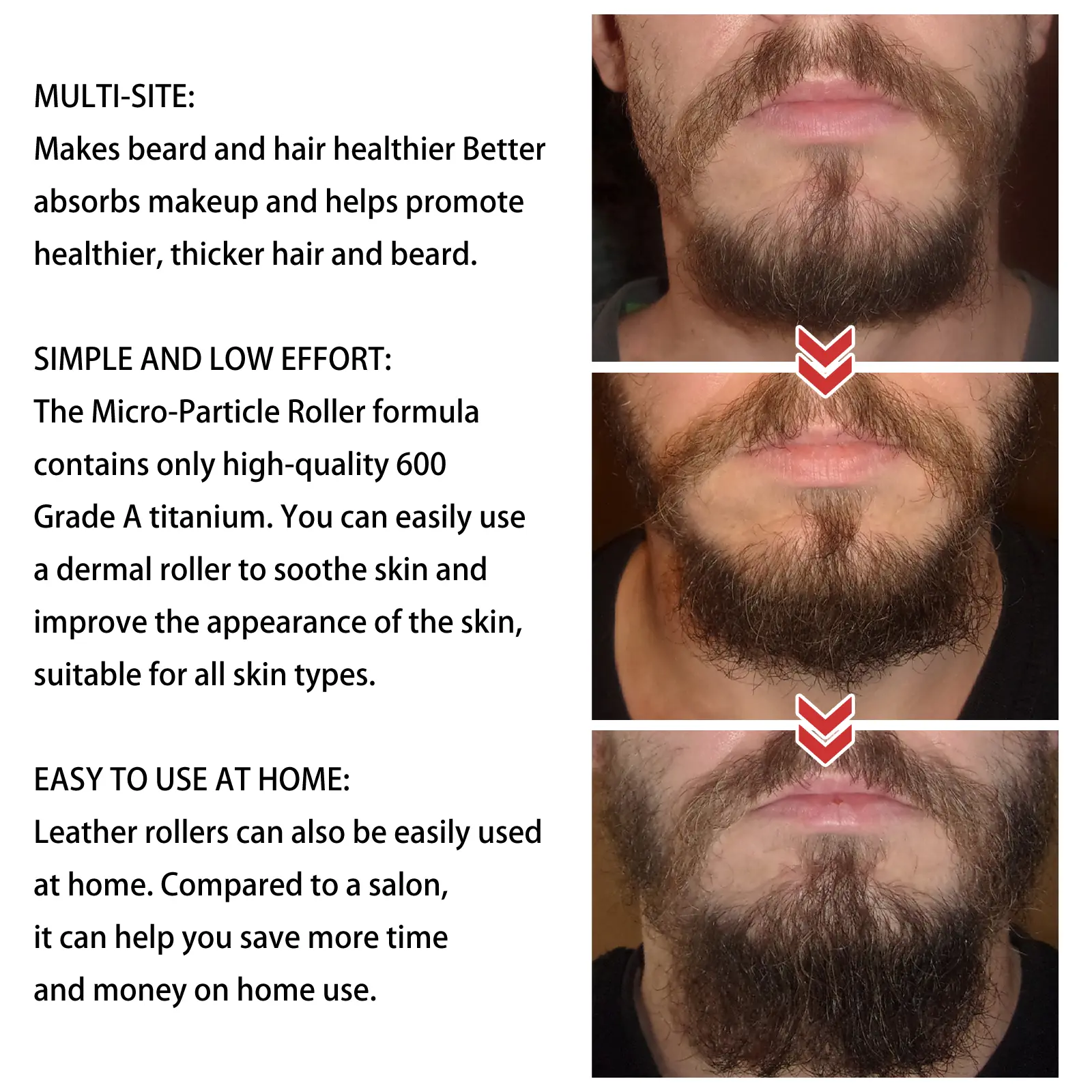 Beard Derma Roller with Moisturizing Comb for Growth Support - West&Month 4 beard derma roller moisturizing repair West Month 052 1756