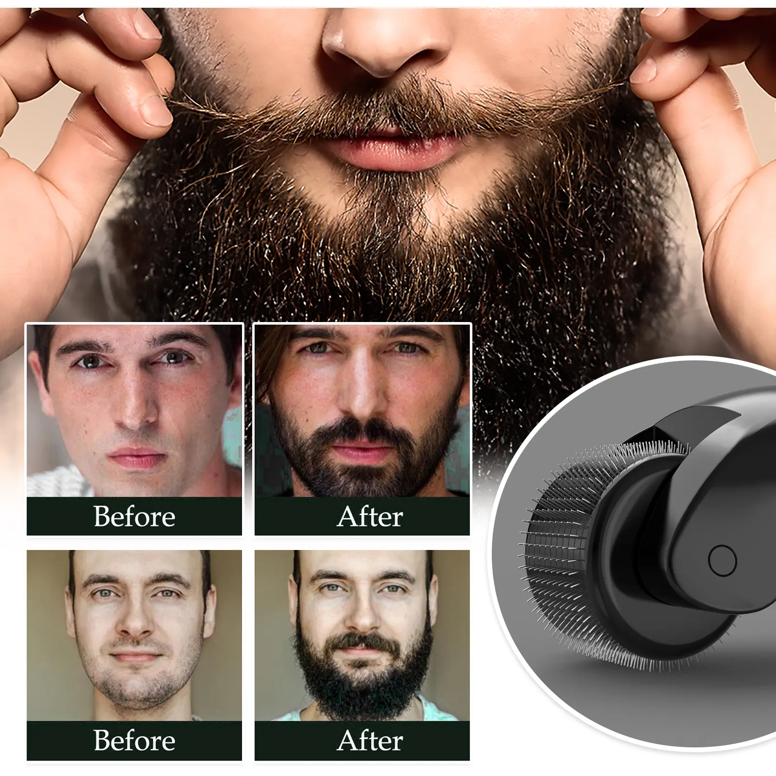 Beard Derma Roller with Moisturizing Comb for Growth Support - West&Month 7 beard derma roller moisturizing repair West Month 052 1759