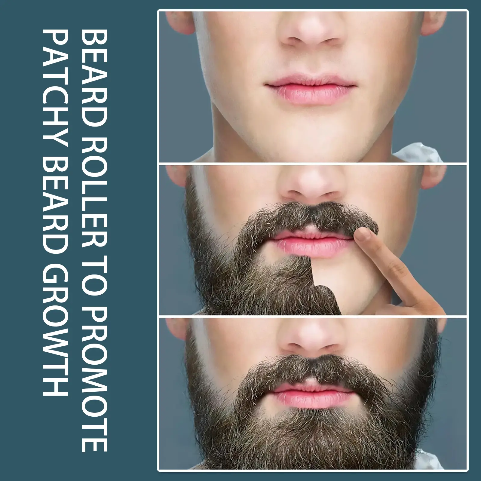 Beard Derma Roller with Moisturizing Comb for Growth Support - West&Month 8 beard derma roller moisturizing repair West Month 052 1760