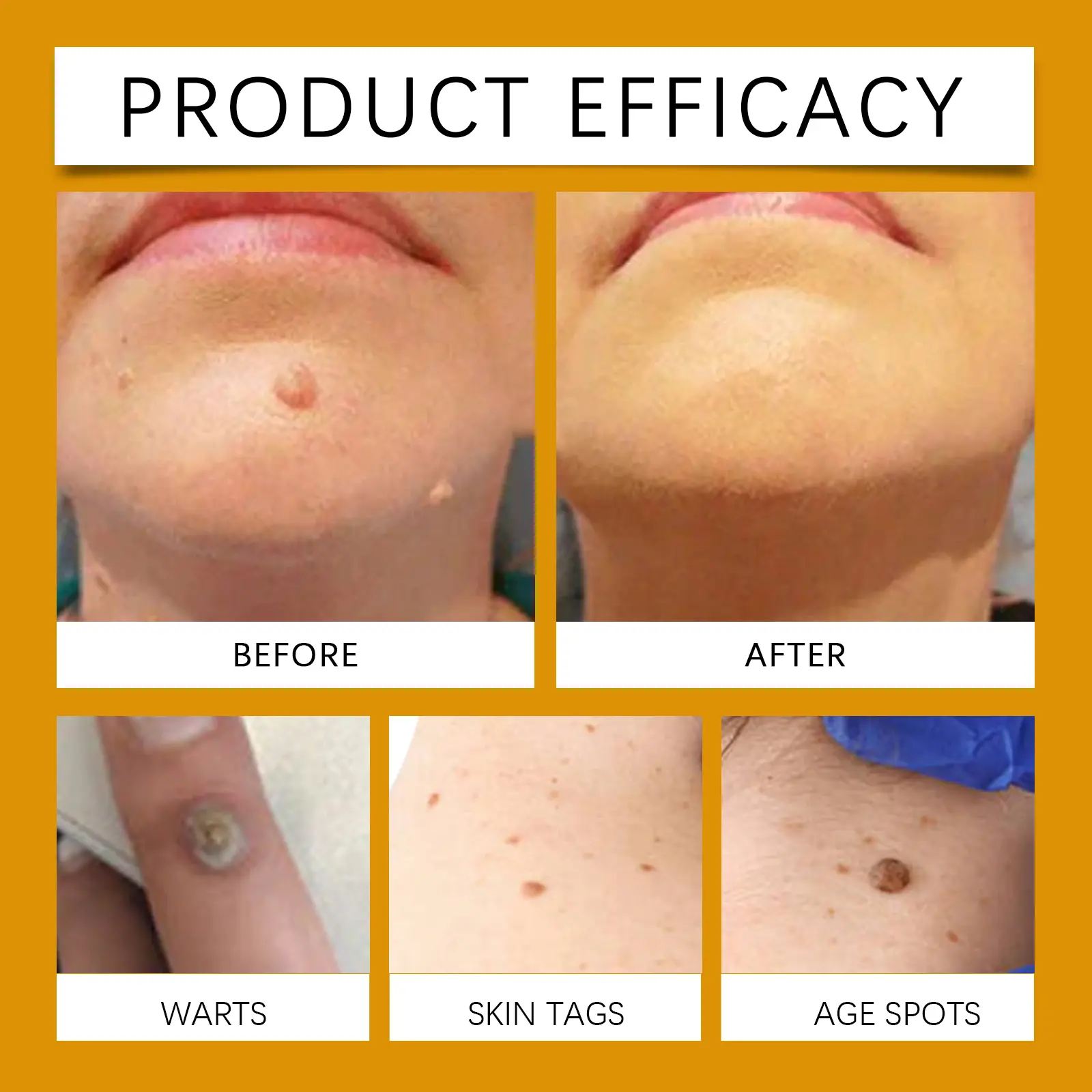 Bee Venom Skin Smoothing Cream Body Repair Kew Care - West 9 beespoison kew cream gentle clean smooth repair West Month 506 7744