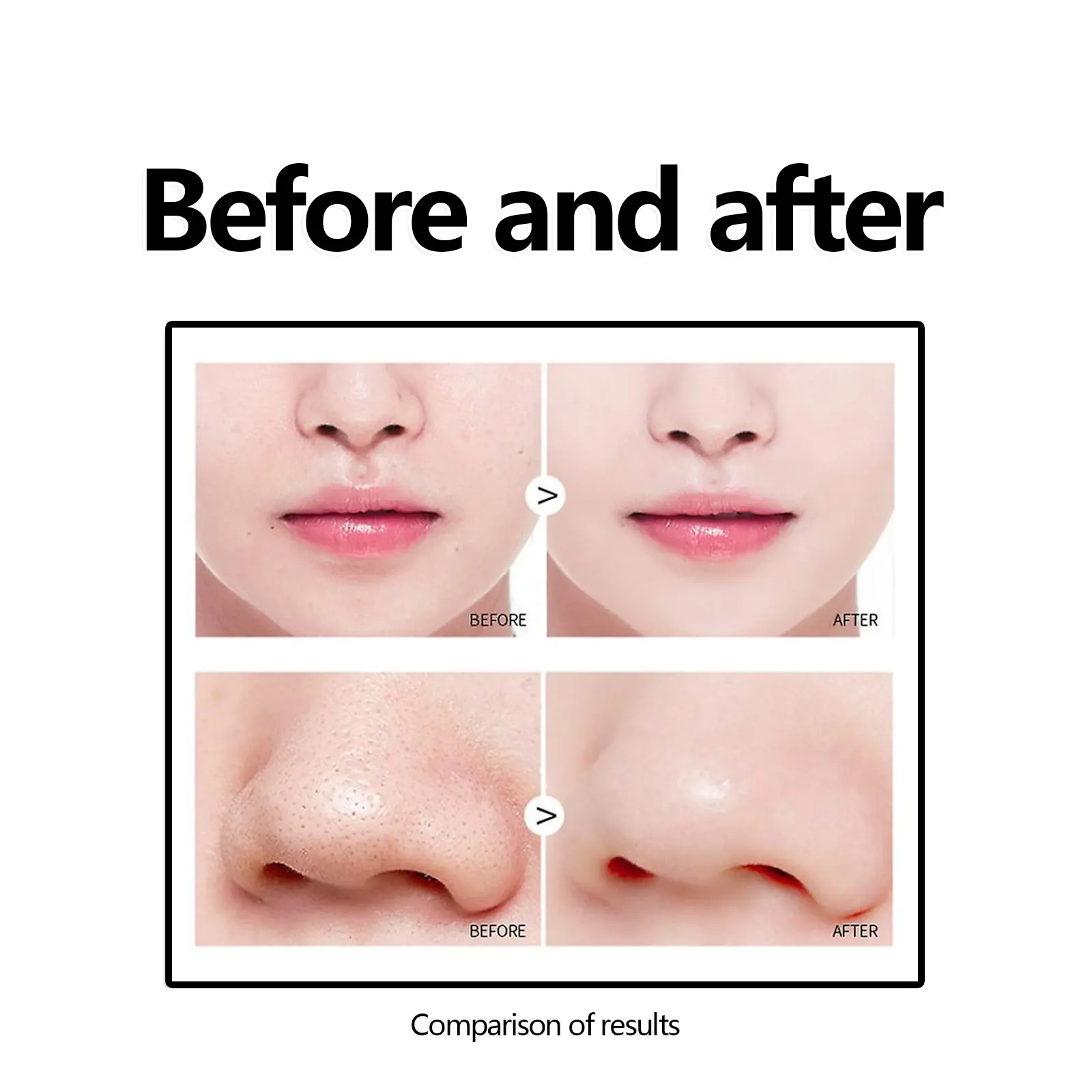 Blackhead Removal Mask for Deep Pore Cleansing - West&Month 8 blackhead mask moisturize clean pimples marks West Month 220 3869