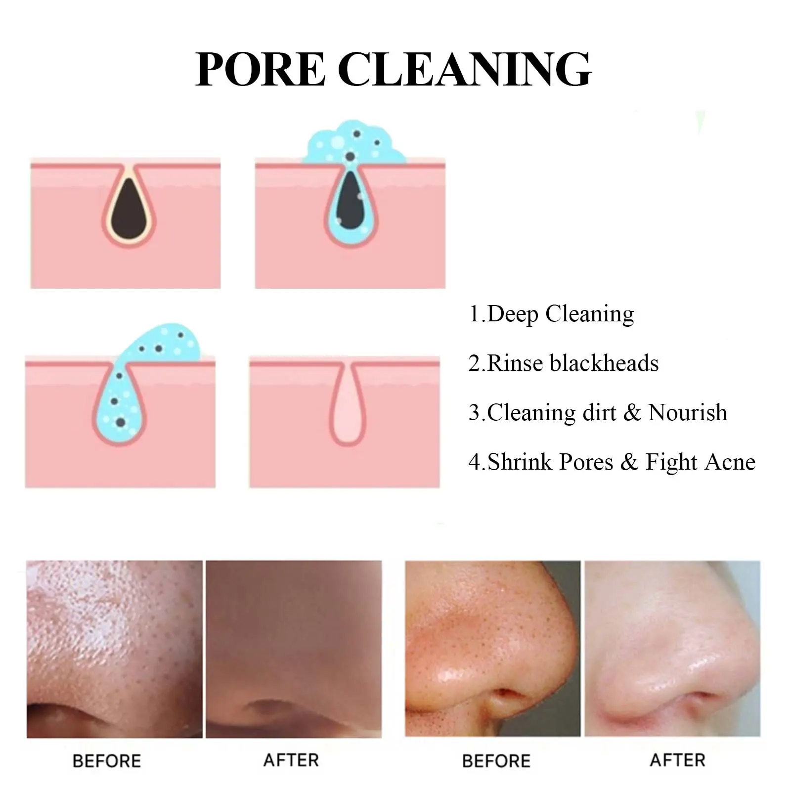 Blackhead Mud Mask Deep Cleansing & Pore Tightening - West&Month 5 blackhead mud mask clean oil tighten pores West Month 225 3934