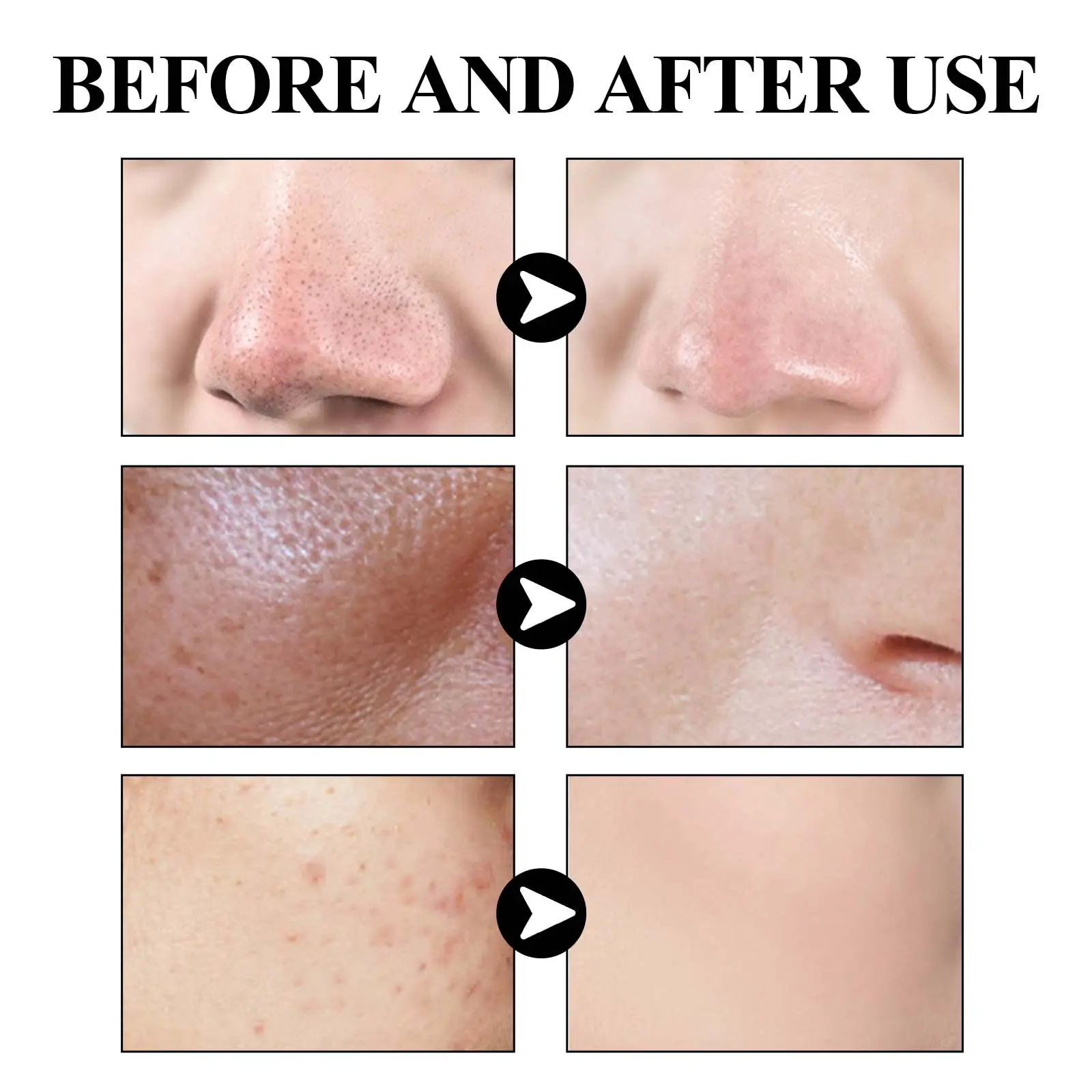 Blackhead Mud Mask Deep Cleansing & Pore Tightening - West&Month 9 blackhead mud mask clean oil tighten pores West Month 225 3937