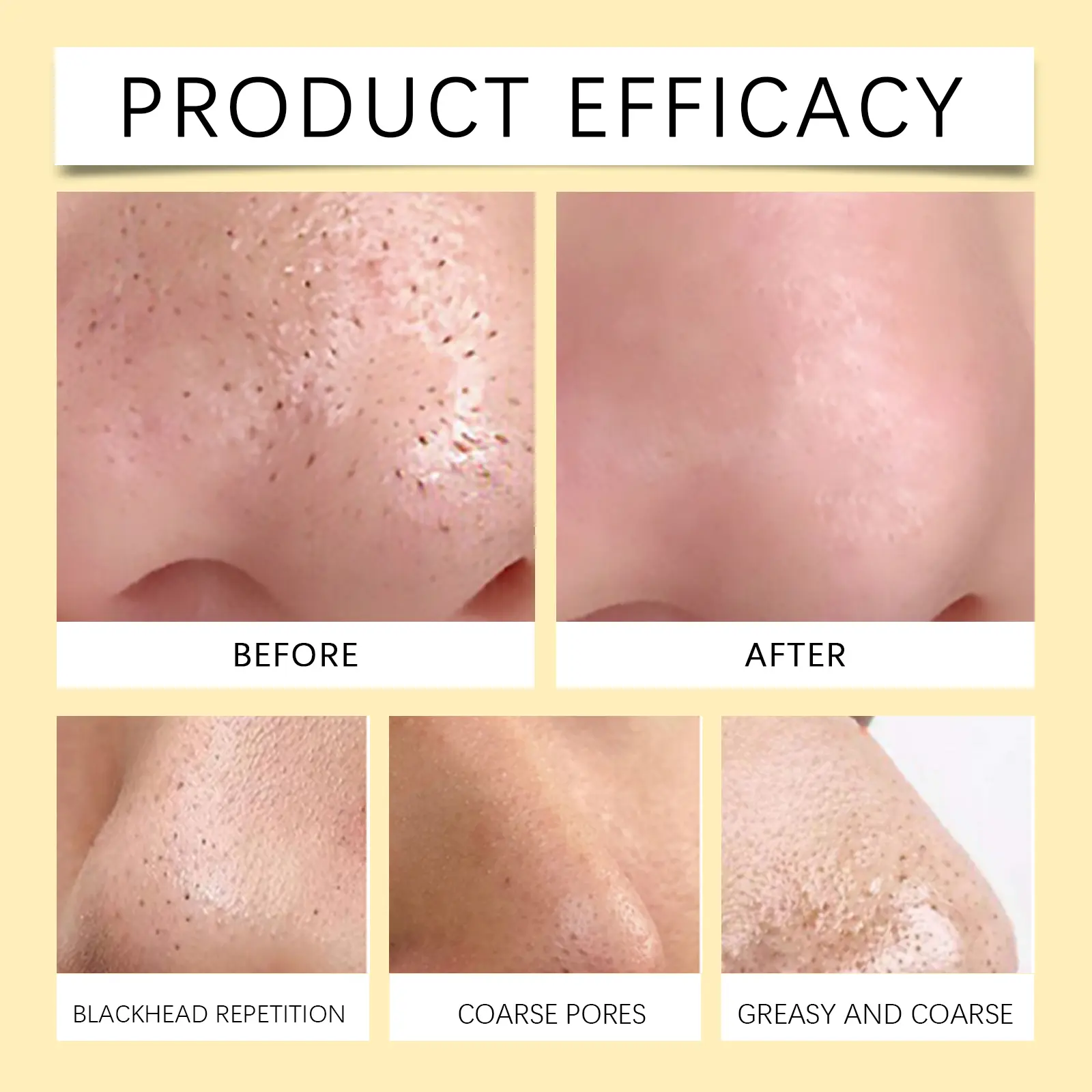 Blackhead Cleansing Nose Mask for Acne & Pores - West&Month 9 blackhead nose mask gentle oil control clean West Month 308 4997