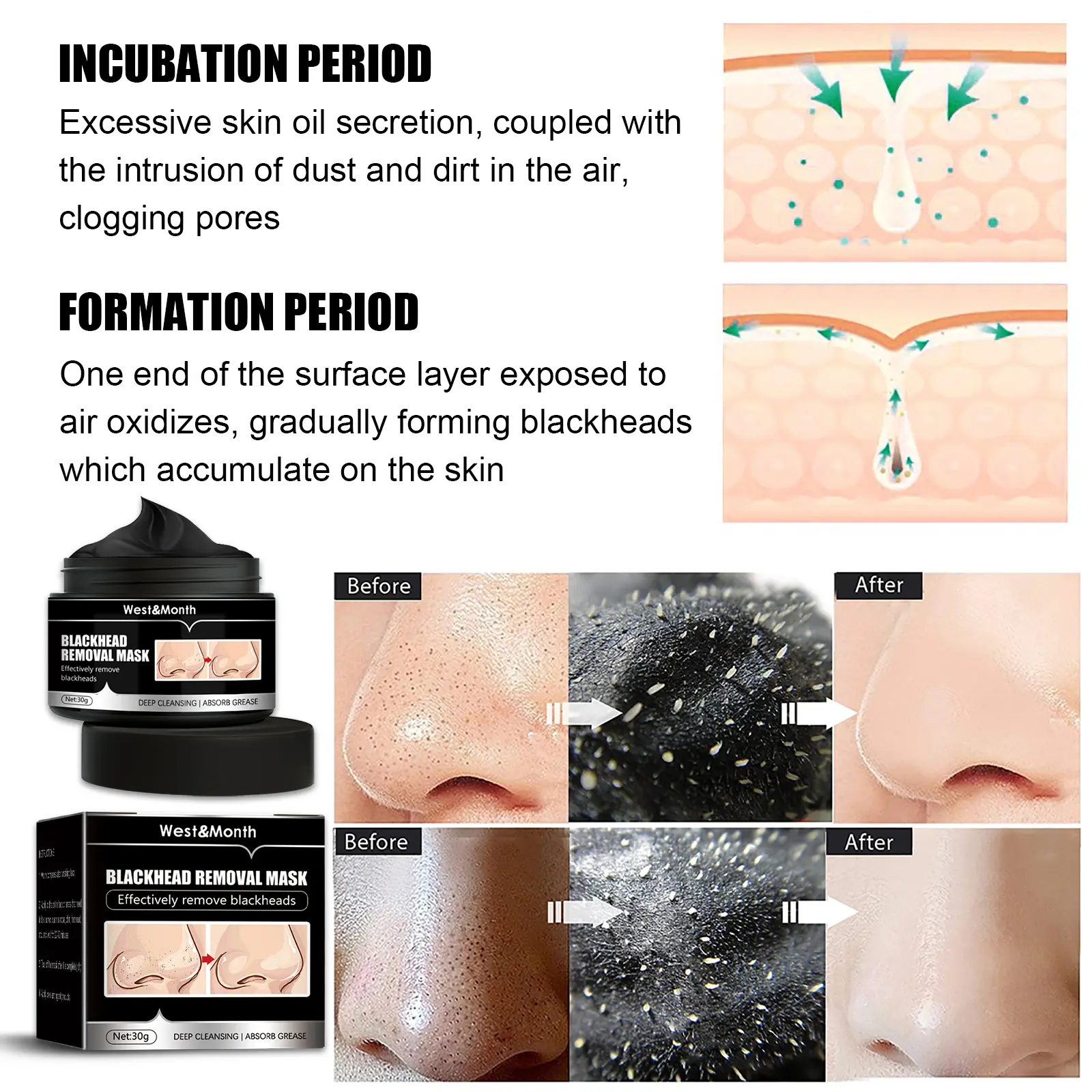 Blackhead Removal Face Mask with Activated Carbon - West&Month 7 blackhead removal mask peel off activated carbon West Month 082 2132