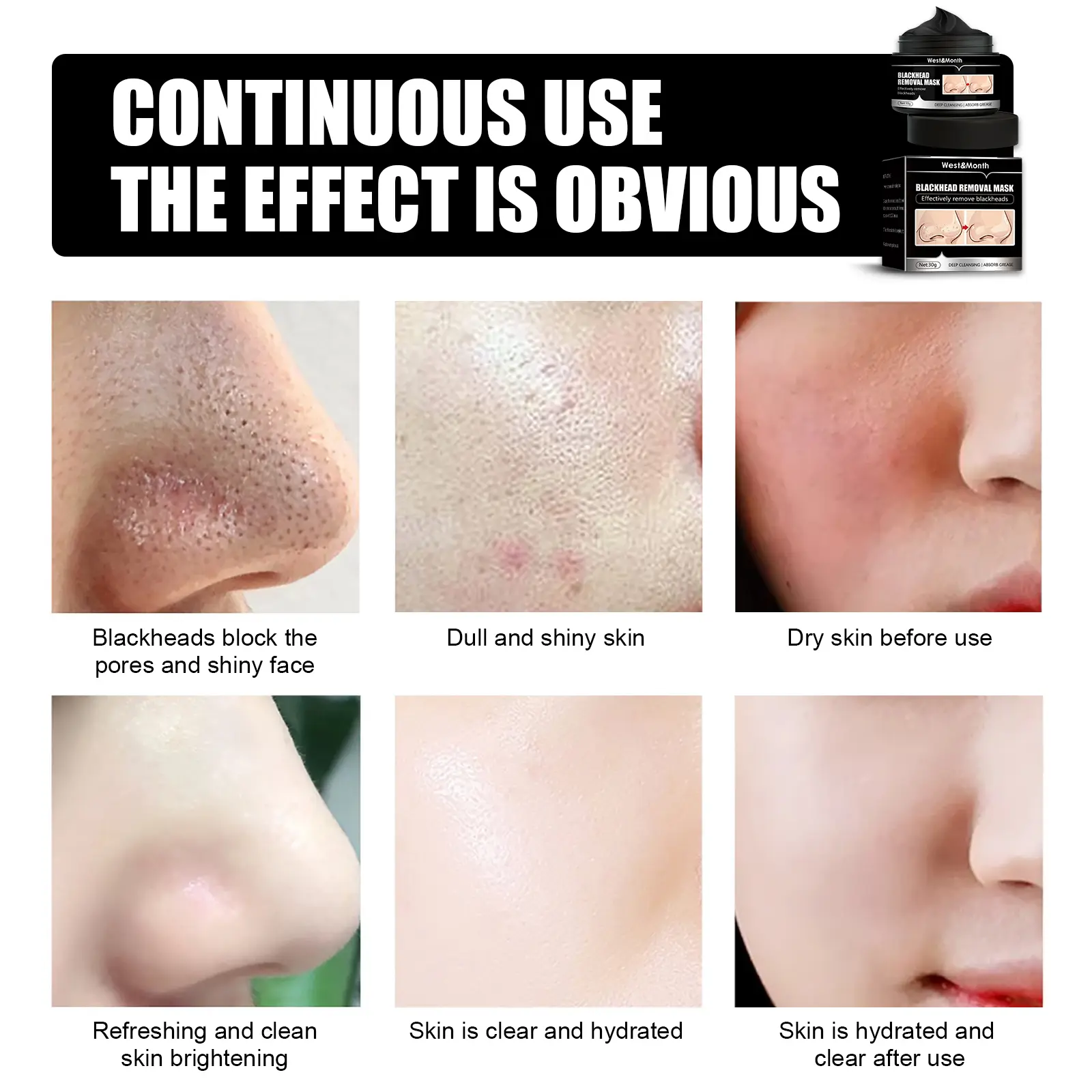 Blackhead Removal Face Mask with Activated Carbon - West&Month 9 blackhead removal mask peel off activated carbon West Month 082 2134