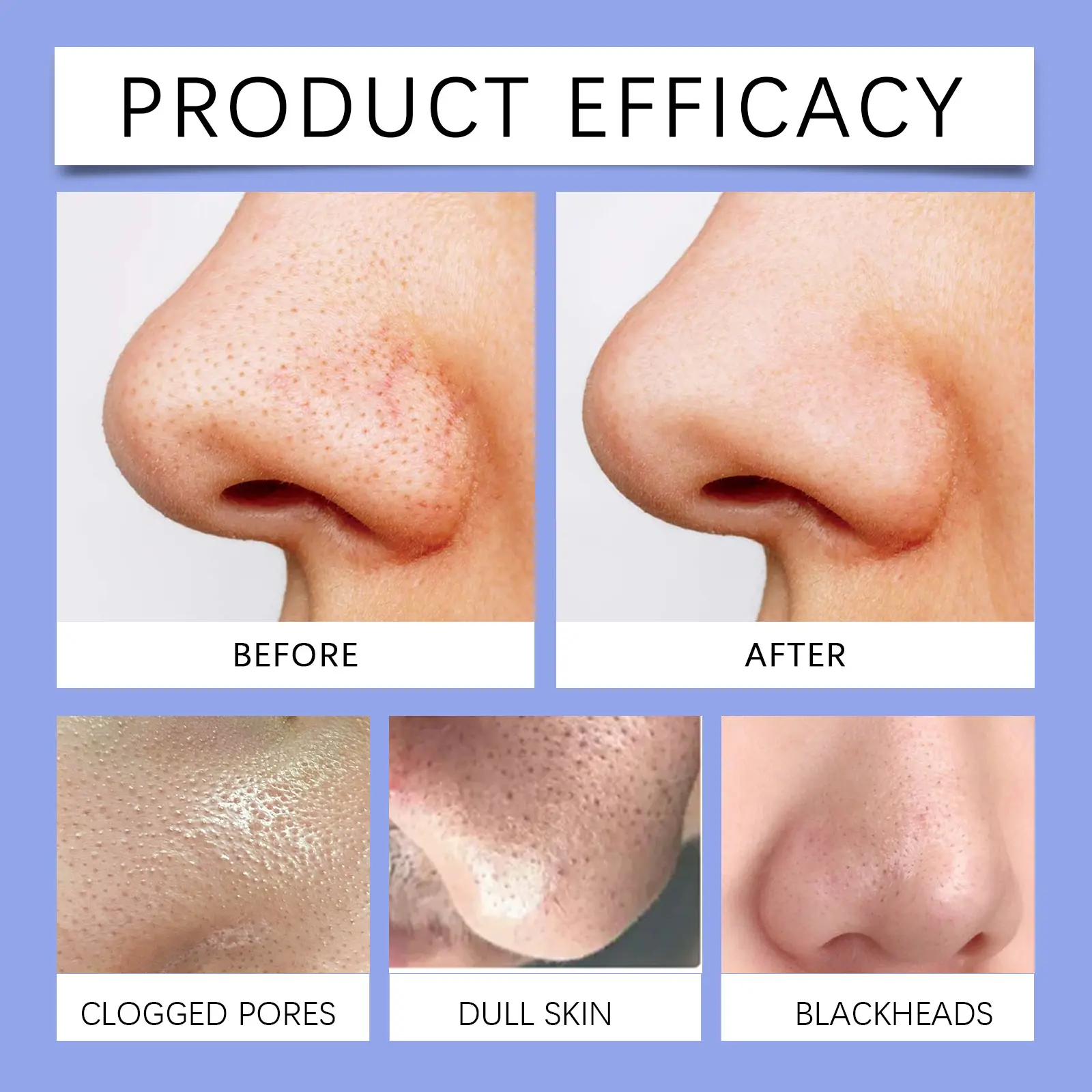 Blackhead Removal Mud Mask with Salicylic Acid - West&Month 9 blackheads mud mask clean oil reduce acne West Month 579 8651