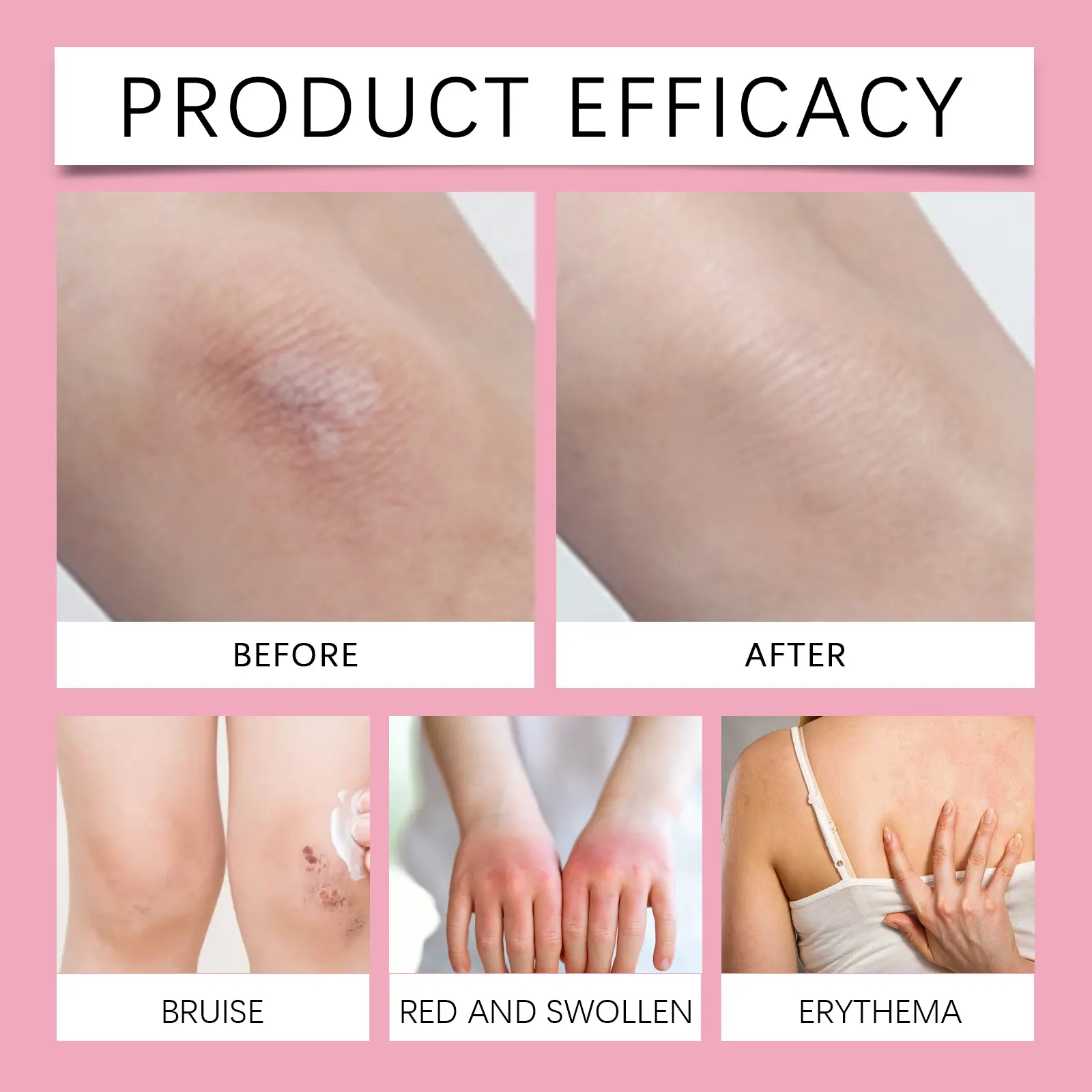 Anti-Friction Moisturizing Stick - Non-Greasy Chafing Protection - West Month 9 body anti friction bar moisturize refresh non greasy West Month 537 8202