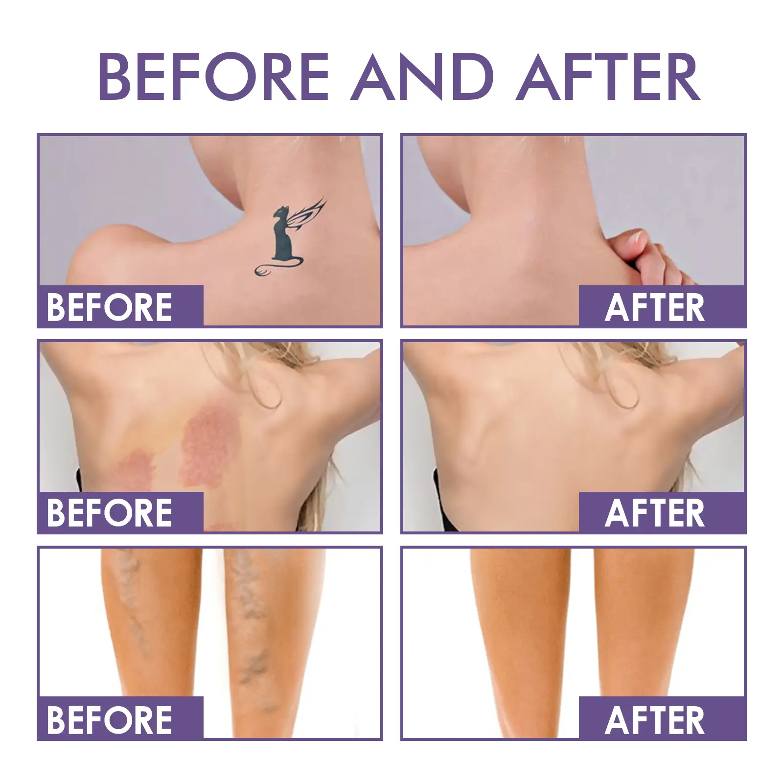 Waterproof Body Concealer for Tattoos and Scars - West&Month 9 body concealer waterproof cover tattoo scars West Month 012 1263