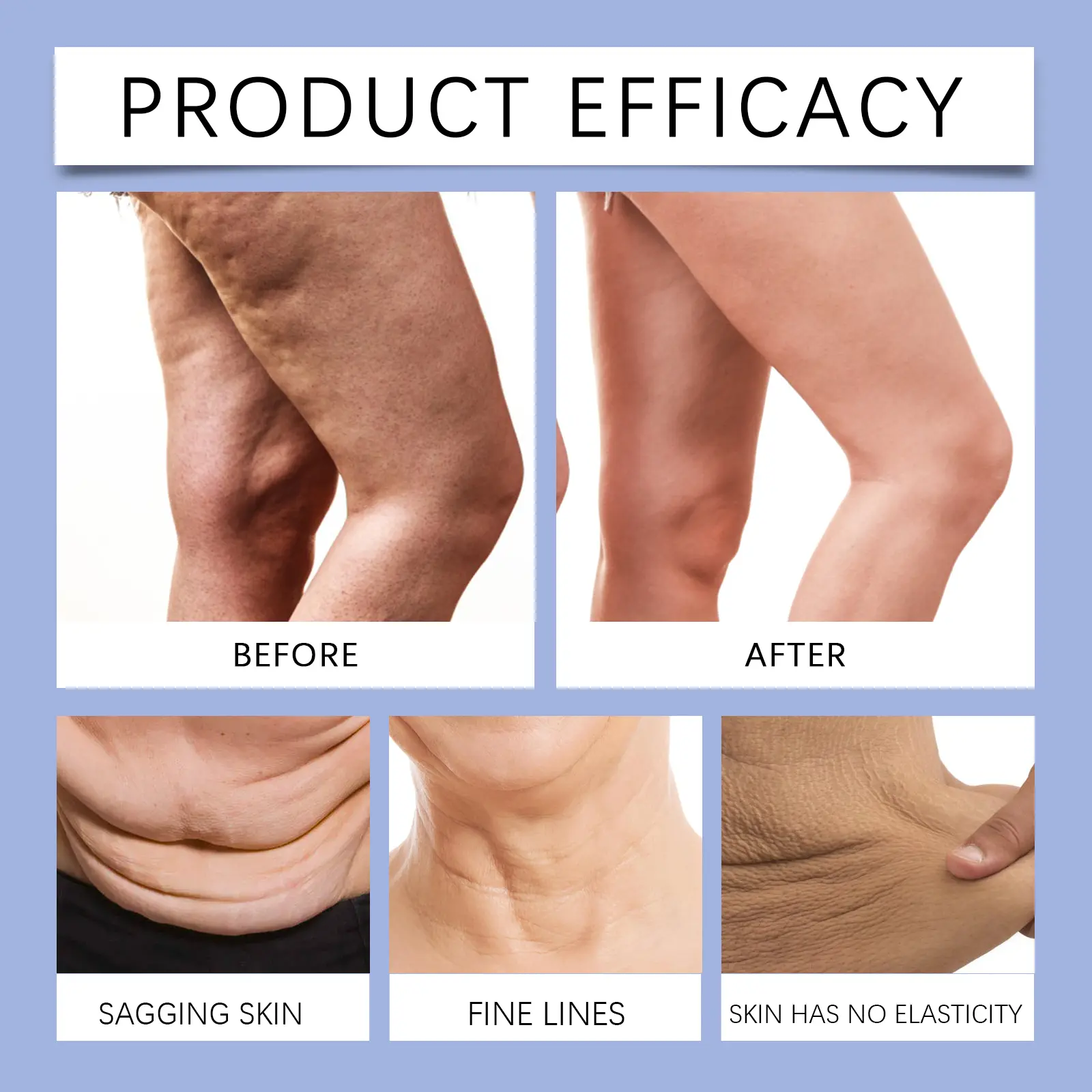 Lactic Acid Body Firming Cream for Skin Tightening - West&Month 9 body firming lactic acid shape sculpting lazy West Month 198 3584