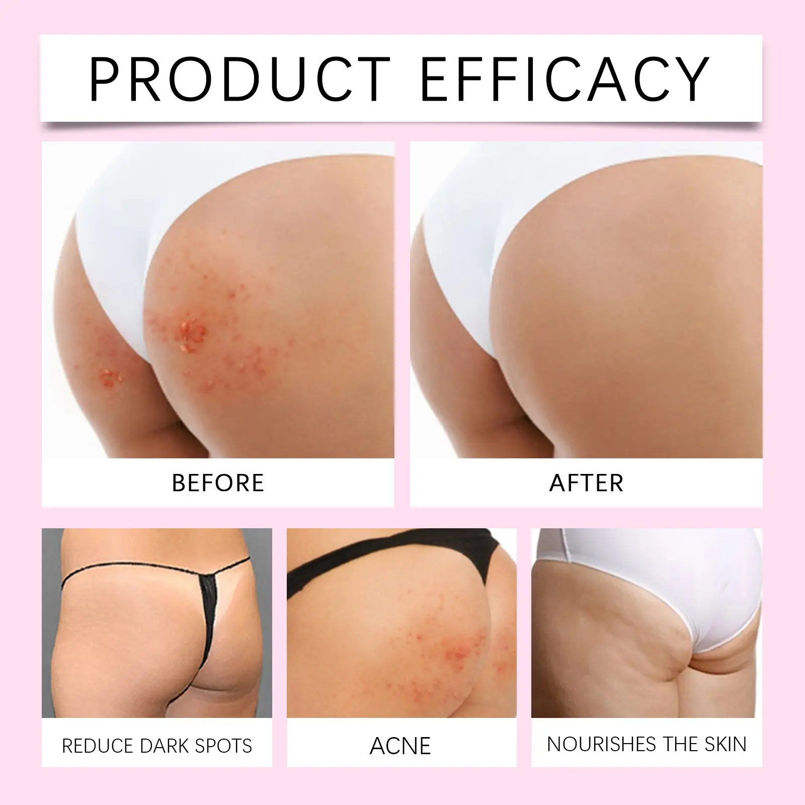 Butt Acne Body Wash Skin Brightening Cleanser West&Month 9 butt acne shower gel clean fade mild refresh West Month 578 8641