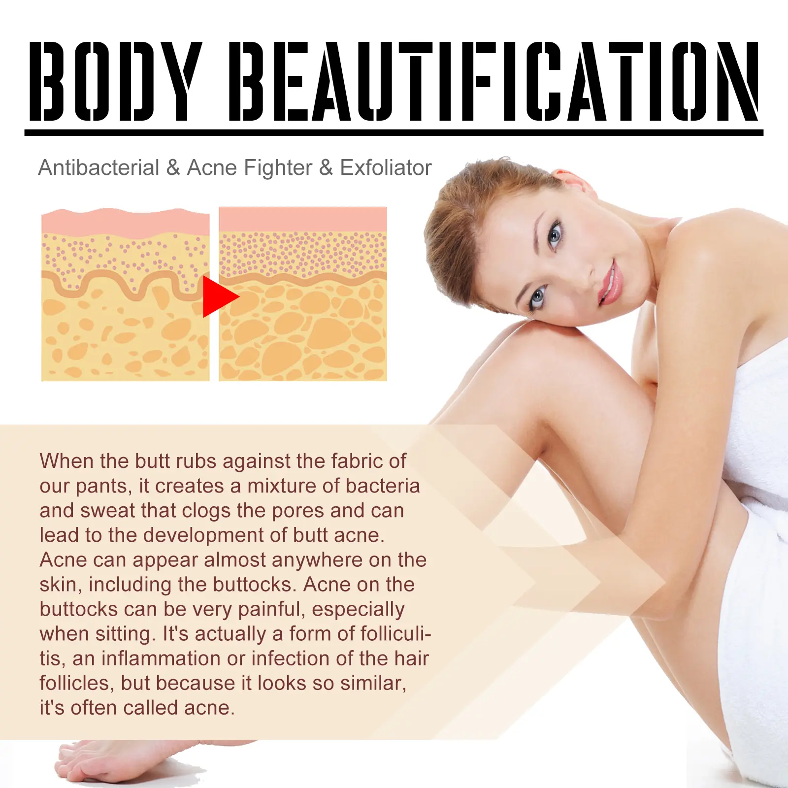 Buttock Care Cream for Rough Skin & Acne Blemishes - West&Month 5 buttock care cream repair rough skin West Month 046 1689
