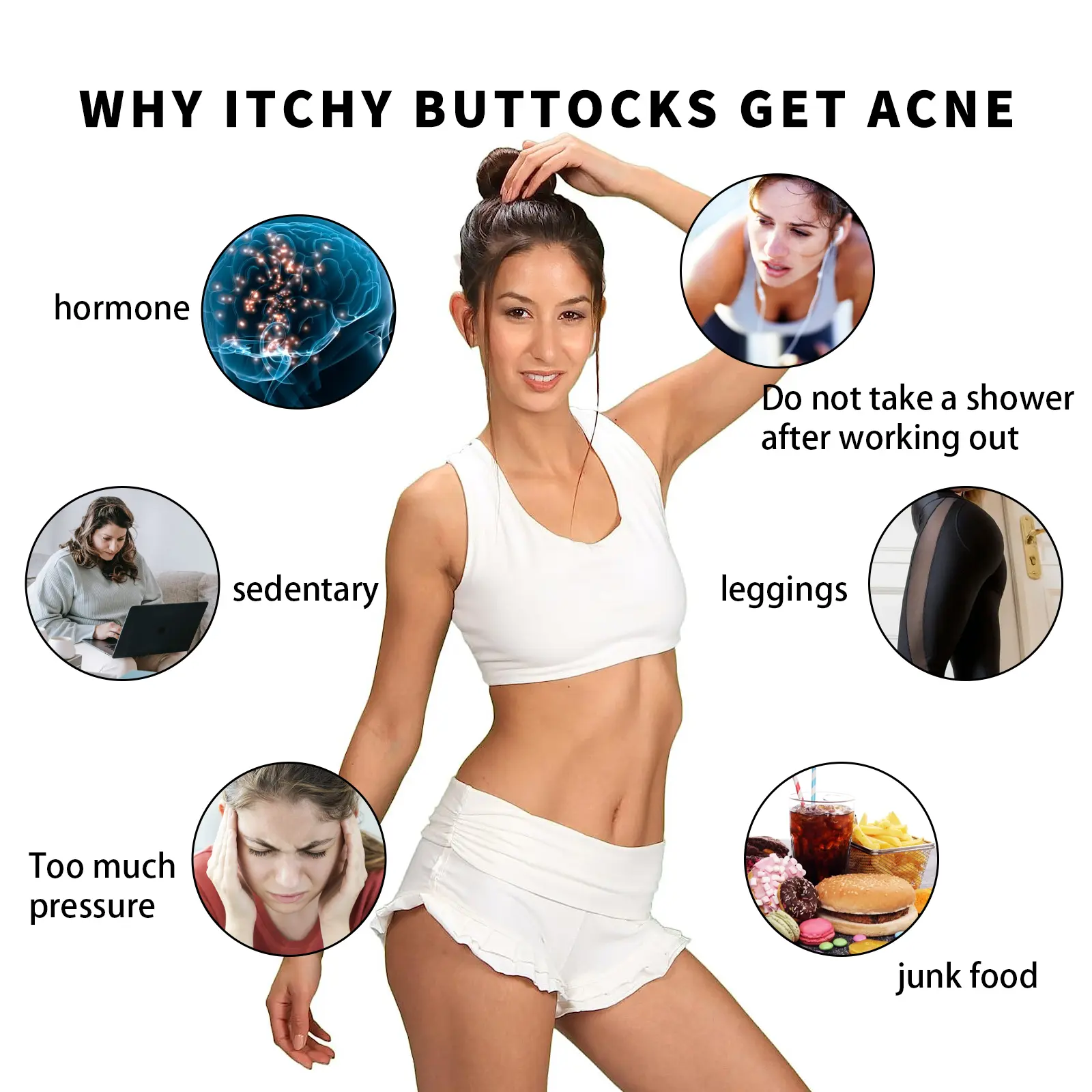 Buttock Care Cream for Rough Skin & Acne Blemishes - West&Month 6 buttock care cream repair rough skin West Month 046 1690