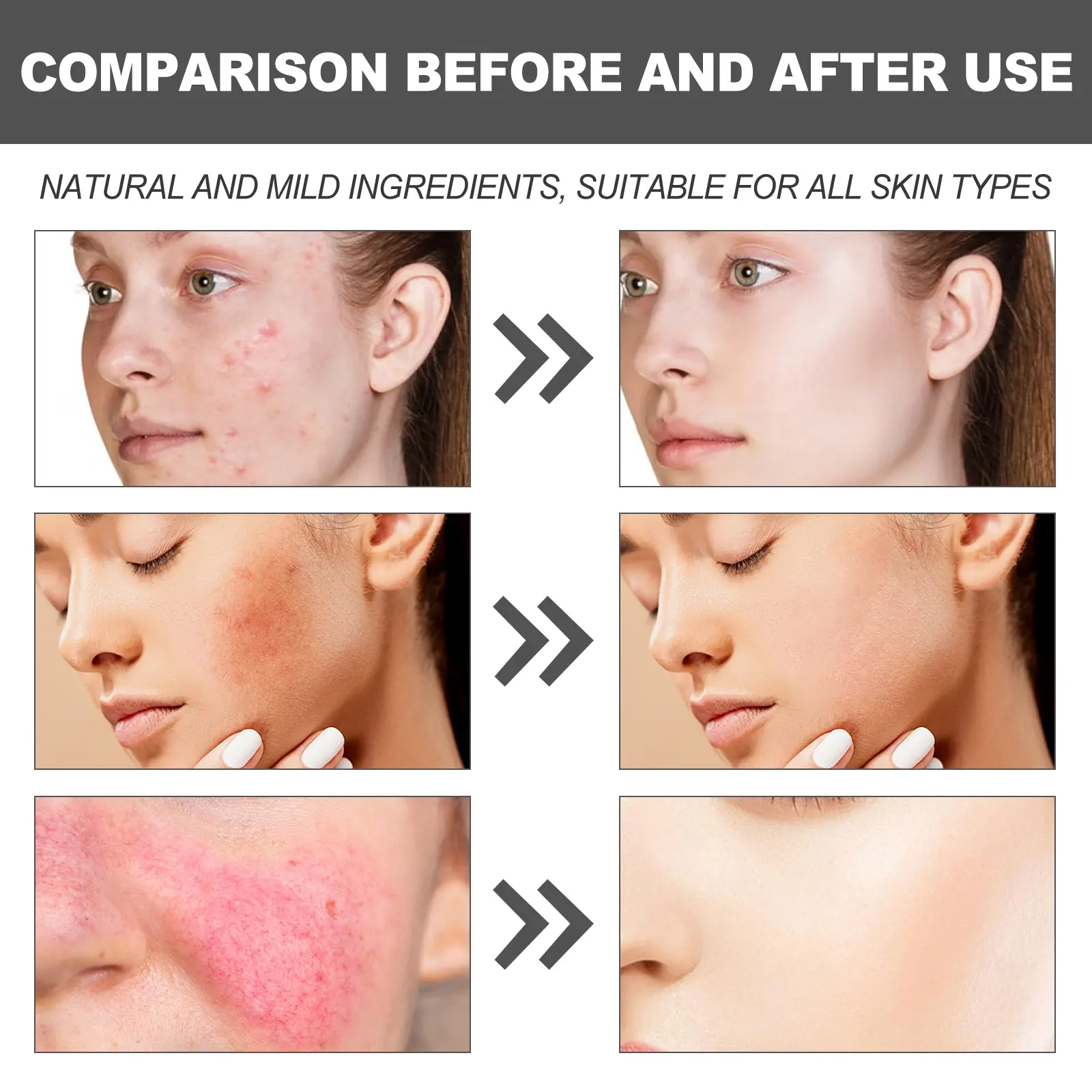Centella Hydra Cream Brightening and Firming Moisturizer - West&Month 9 centella hydra cream brighten firm smooth West Month 294 4830