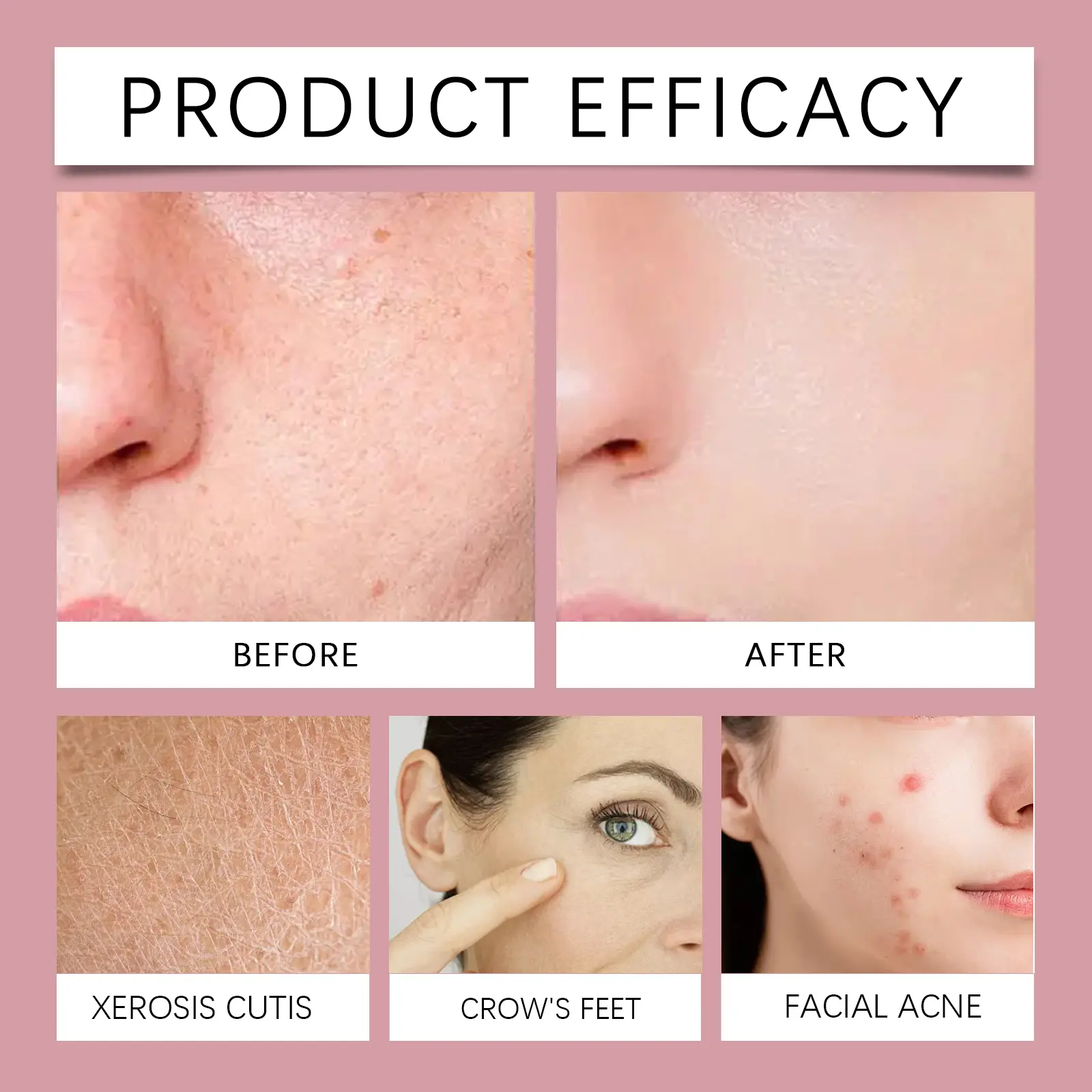 Collagen Facial Pads Brightening & Firming Treatment - West&Month 9 collagen cotton pad facial brightening moisturizing West Month 096 2327