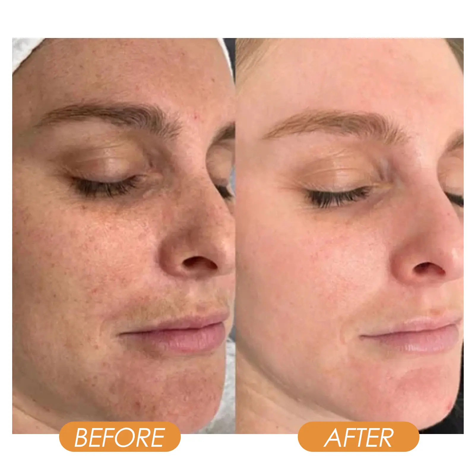 Collagen Eye Mask Spray Hydrating Facial Treatment West&Month 9 collagen eye mask spray anti aging hydrating West Month 109 2491