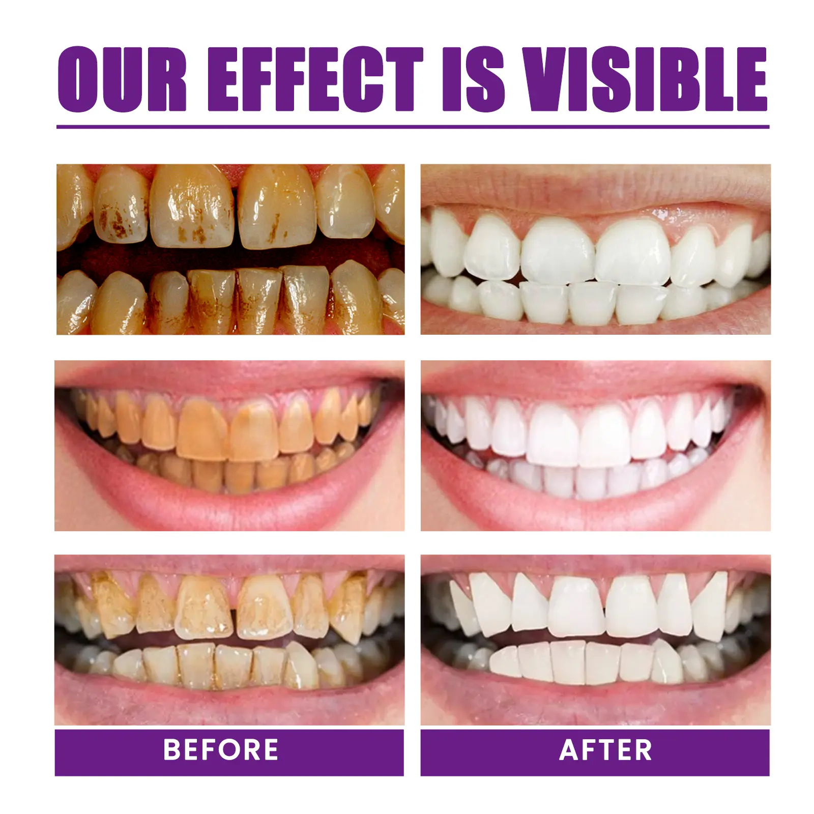 Color Correcting Toothpaste for Teeth Whitening & Stain Removal West&Month 7 color correcting teeth whitening toothpaste West Month 016 1309
