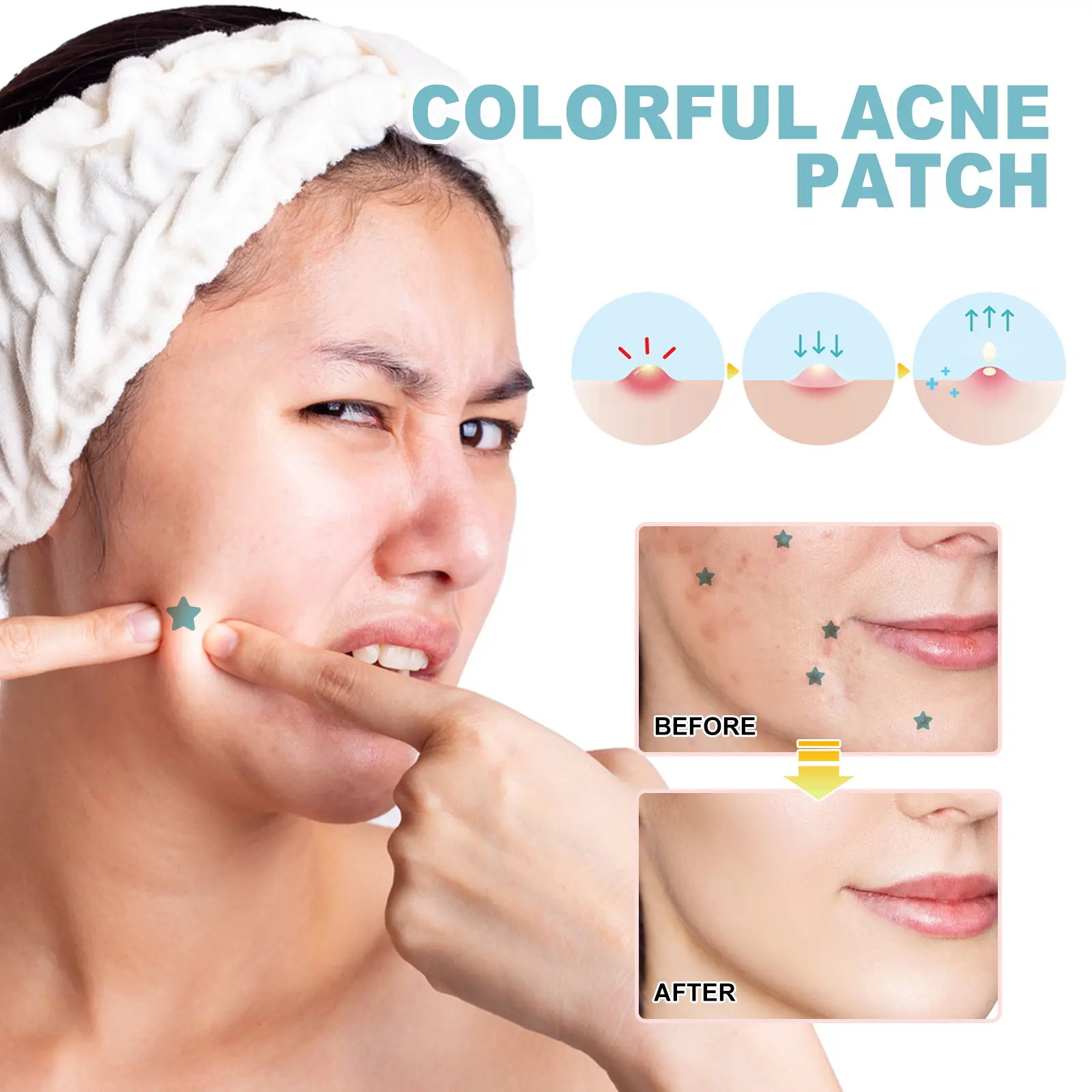 Colorful Acne Patches for Skin Repair and Gentle Cleansing - West&Month 7 colorful acne patch gently clean repair impurities West Month 425 6591
