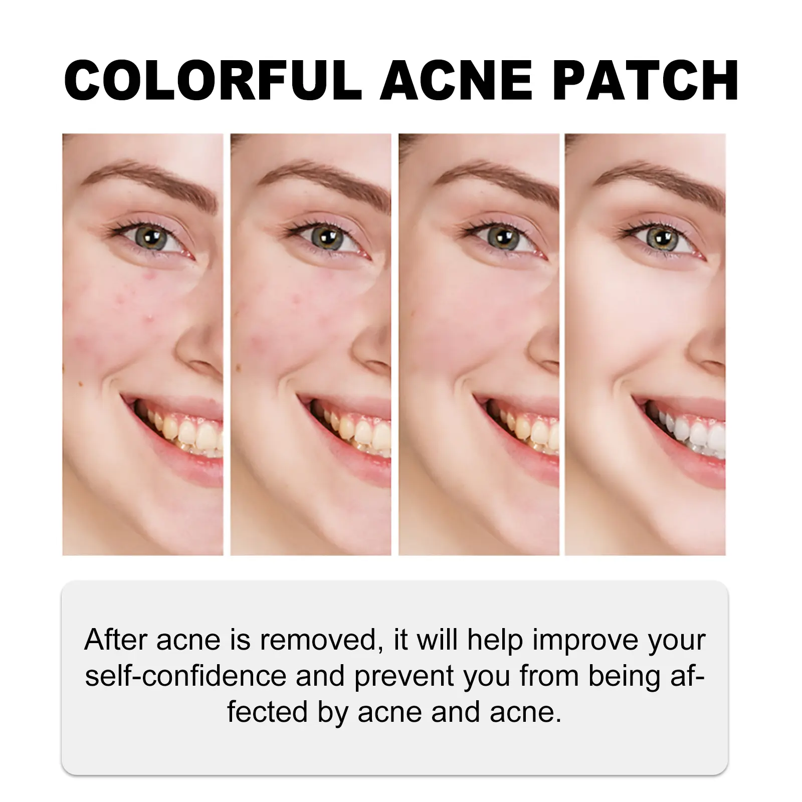 Colorful Acne Patches for Skin Repair and Gentle Cleansing - West&Month 9 colorful acne patch gently clean repair impurities West Month 425 6593