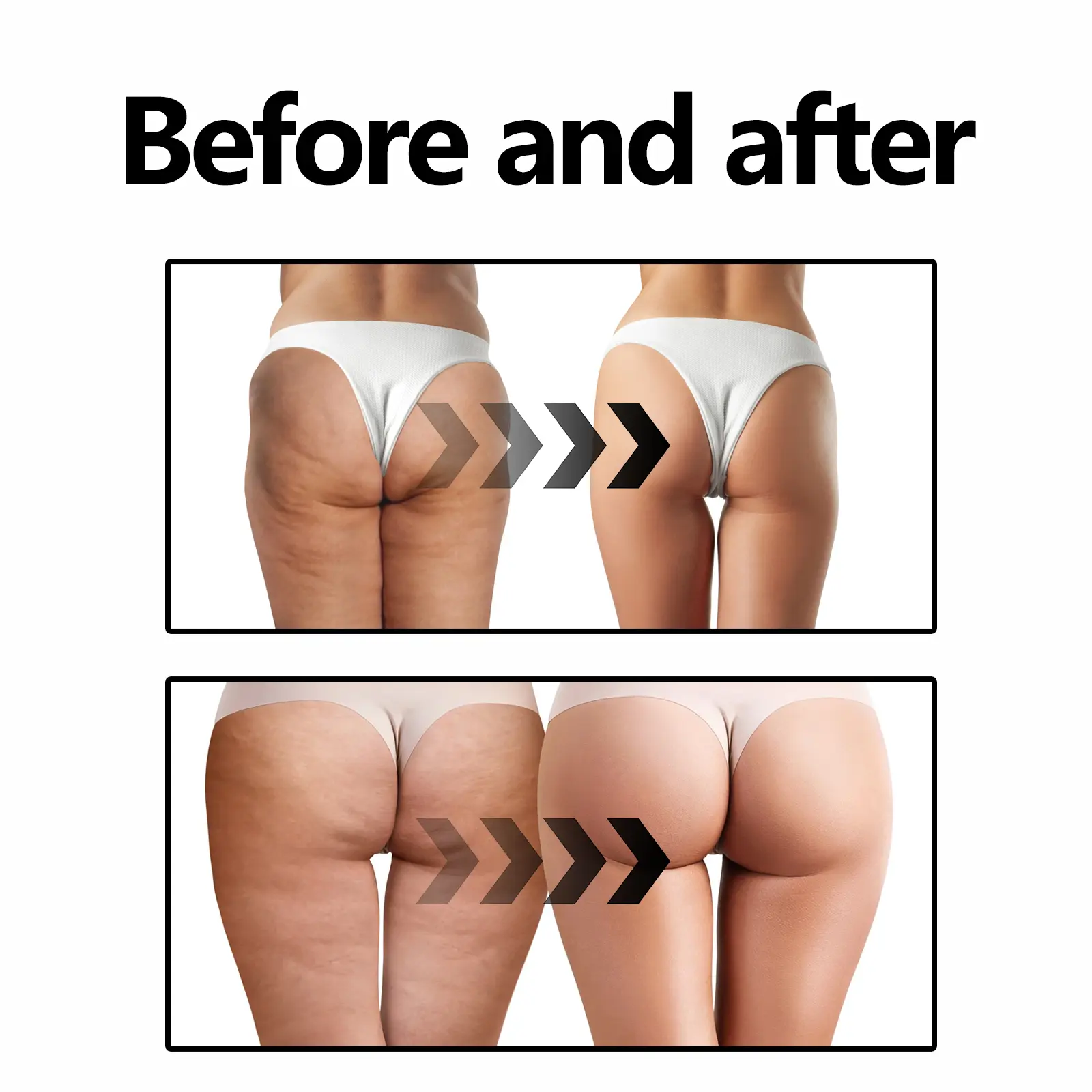Curve Enhancing Cream for Hips and Body Contouring - West&Month 8 curve enhancing cream sculpt hips firm curves West Month 094 2300
