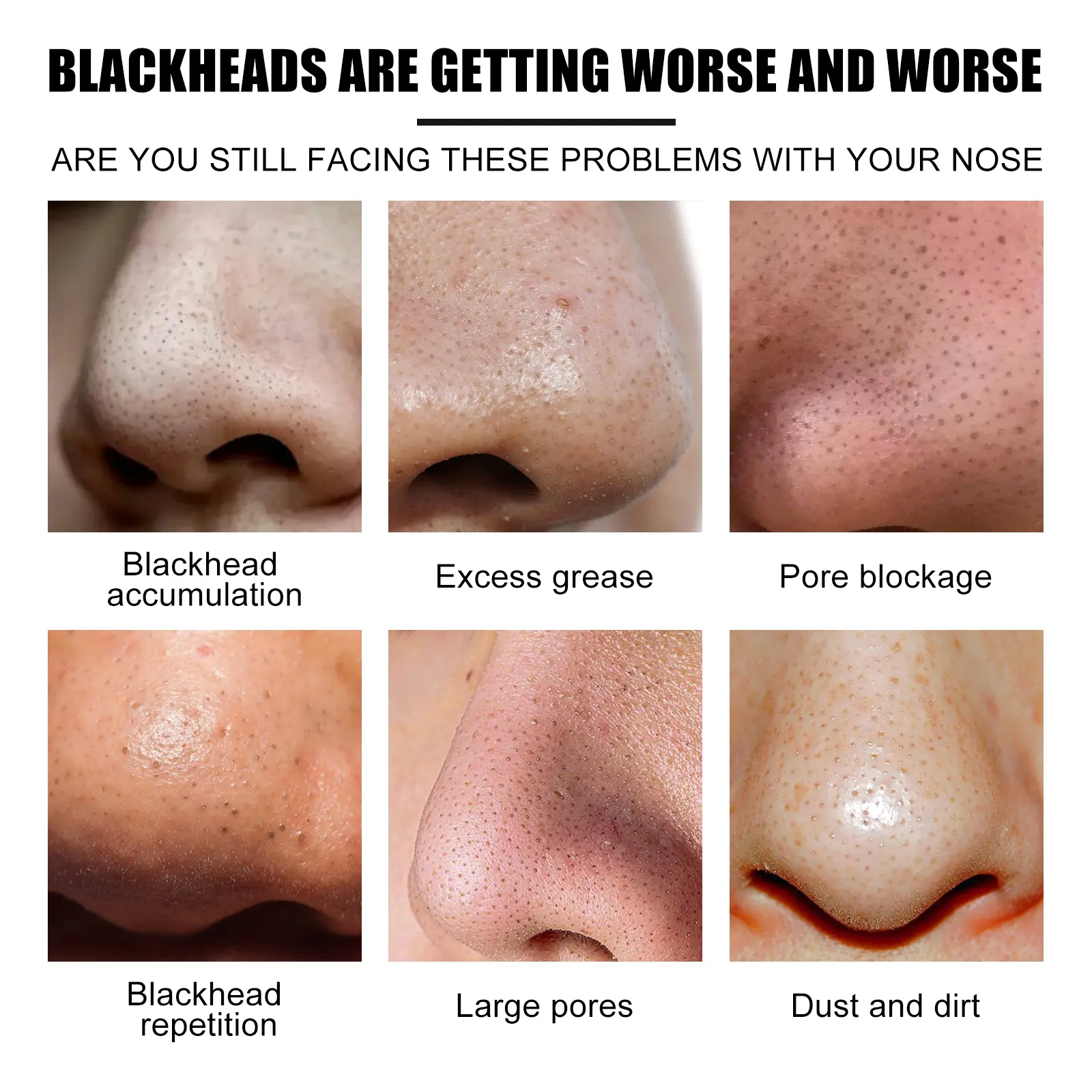 Nose Pore Strips for Blackheads Deep Cleaning Peel-off Mask West&Month 7 deep clean nose strips remove blackhead tight pores West Month 349 5534