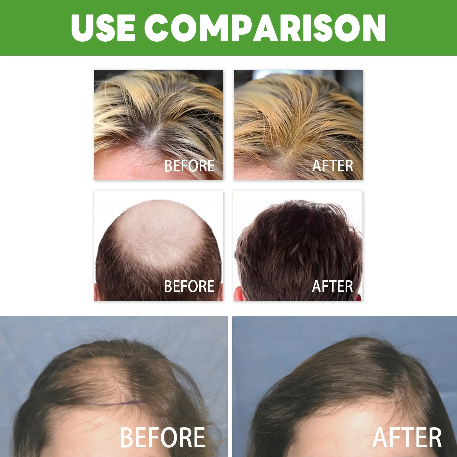 Hair Thickening Spray for Anti-Hair Loss & Strengthening - West&Month 9 dense hair spray anti loss thicken strengthen West Month 188 3475