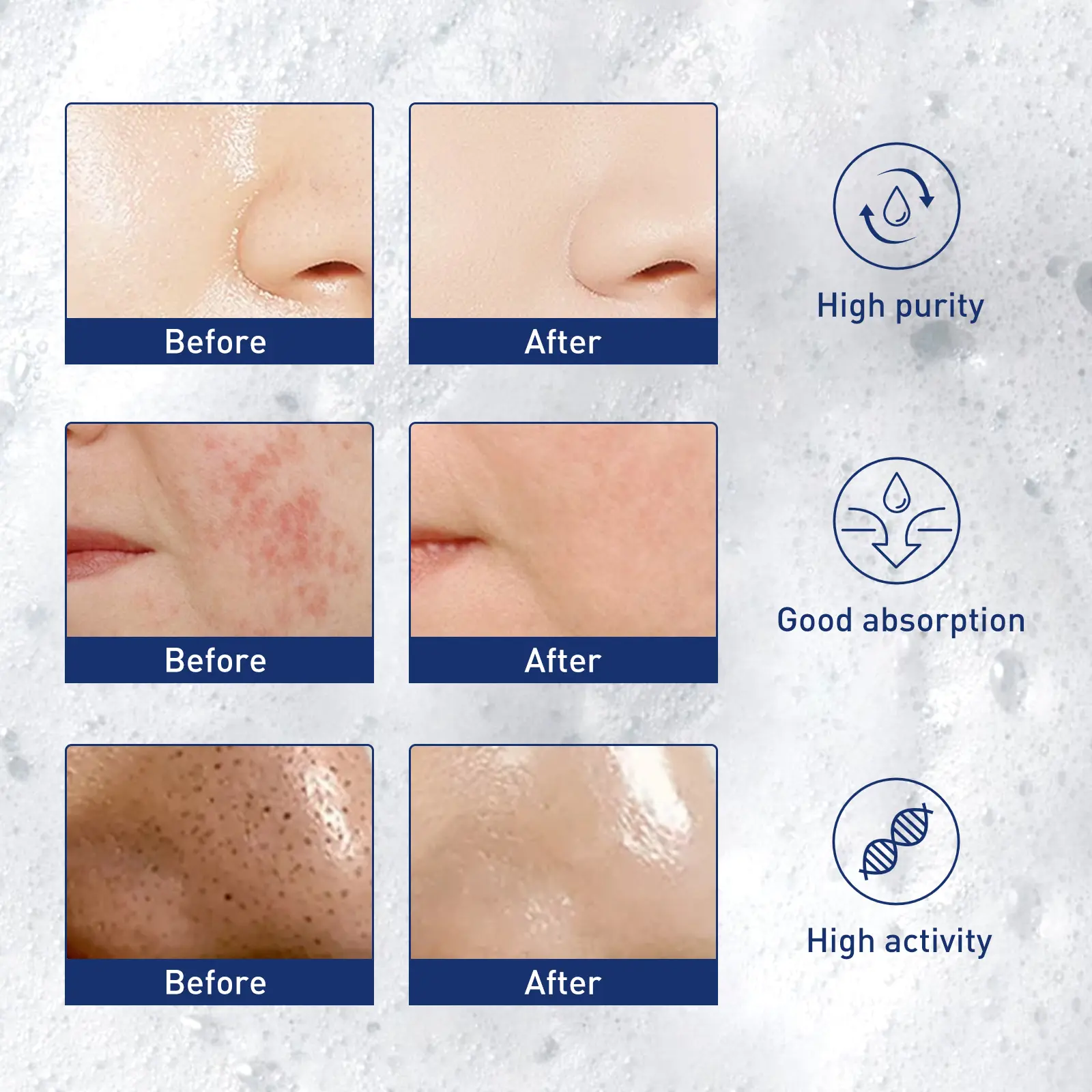 Exfoliating Mousse Cleanser for Pore Control & Blackheads - West&Month 7 exfoliating mousse clean pore control oil West Month 399 6239