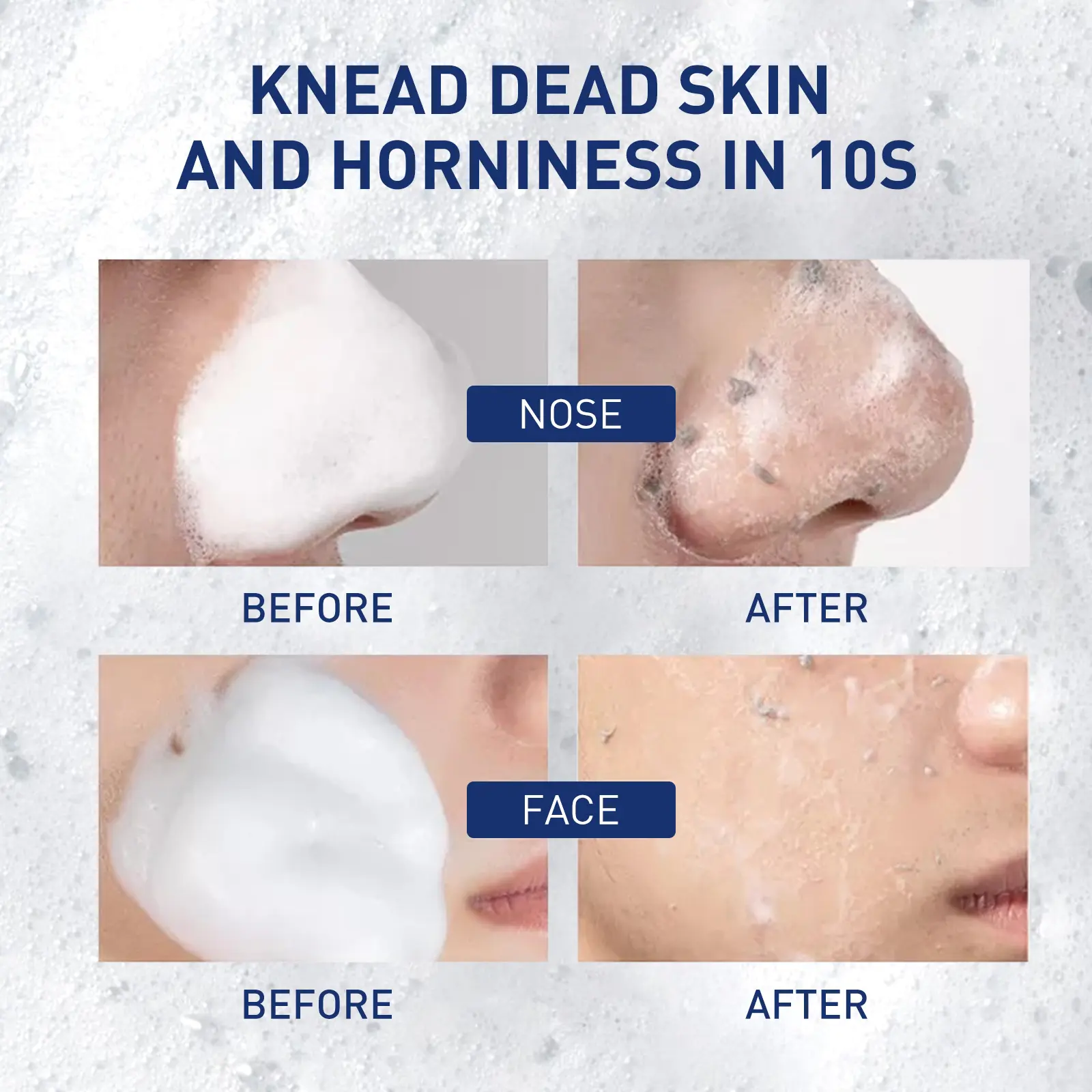 Exfoliating Mousse Cleanser for Pore Control & Blackheads - West&Month 9 exfoliating mousse clean pore control oil West Month 399 6241