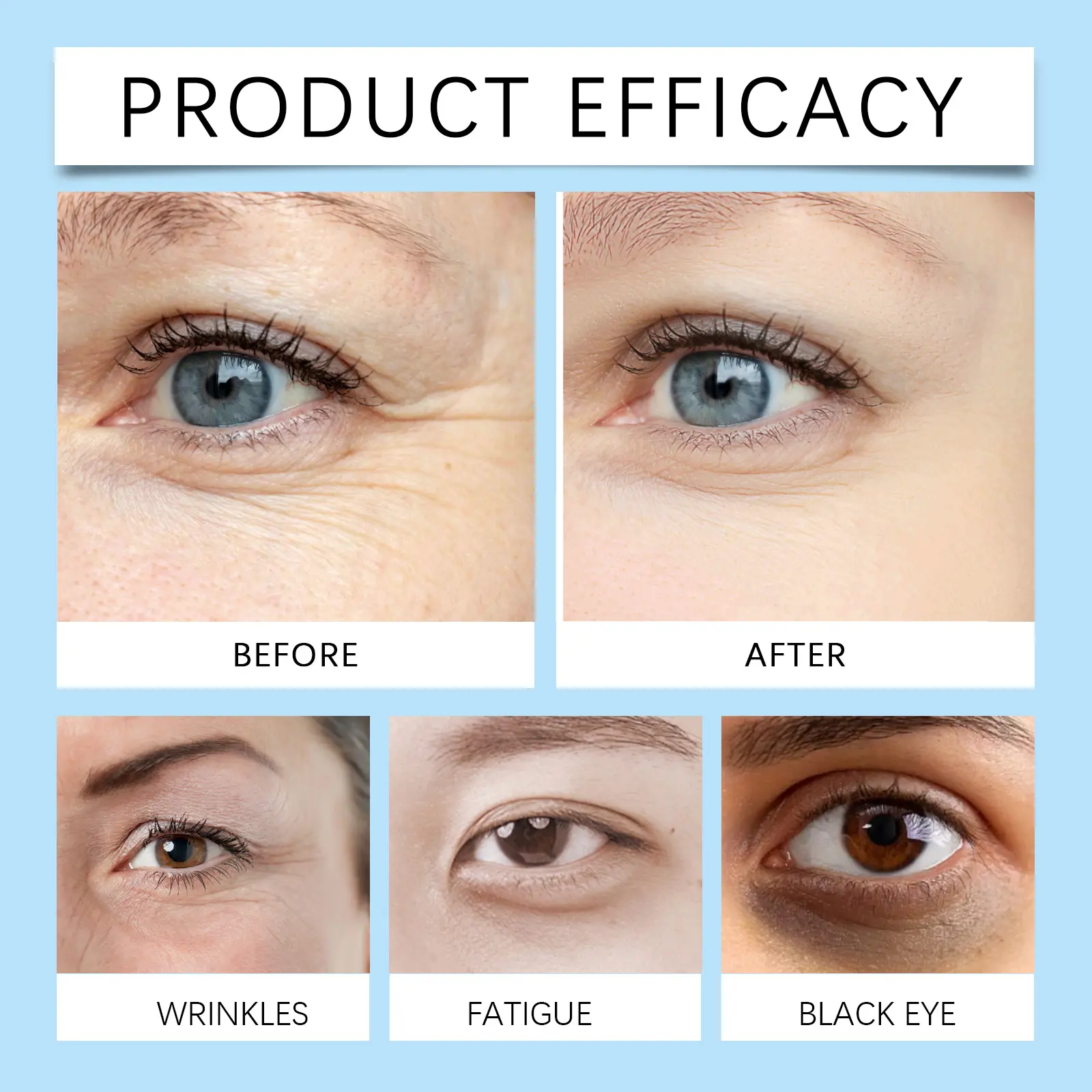 Eye Essence for Dark Circles, Puffiness & Fine Lines - West&Month 9 eye essence lighten lines gently care moisturize West Month 601 8866