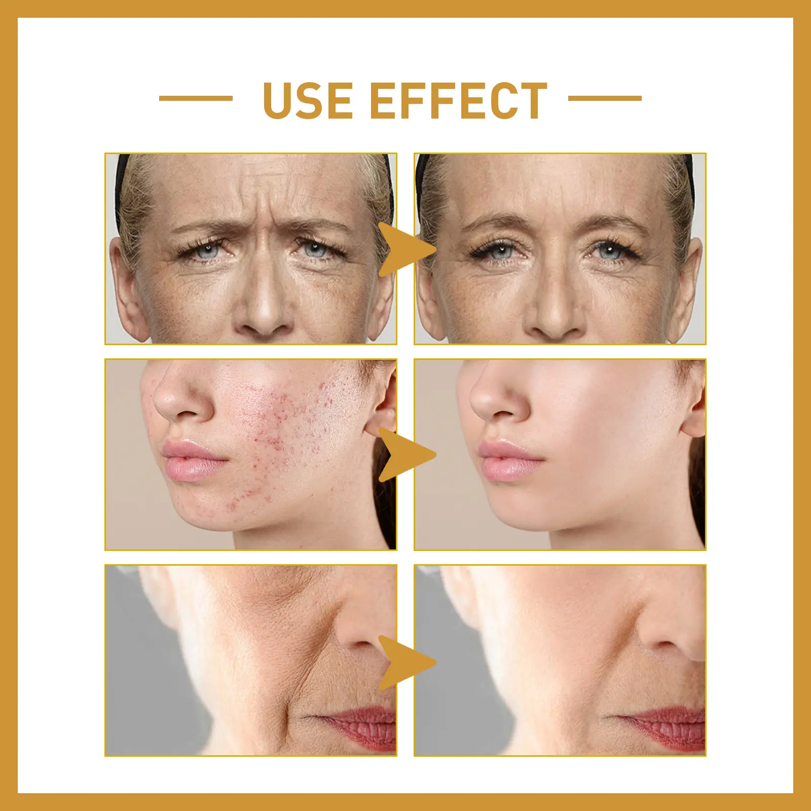 White Rice Essence Hydrating Serum for Smooth Skin - West&Month 8 face rice essence lighten lines improve acne West Month 284 4692