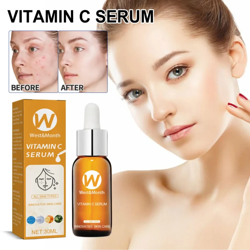 facial essence lighten acne mark oil control West Month 332 5290