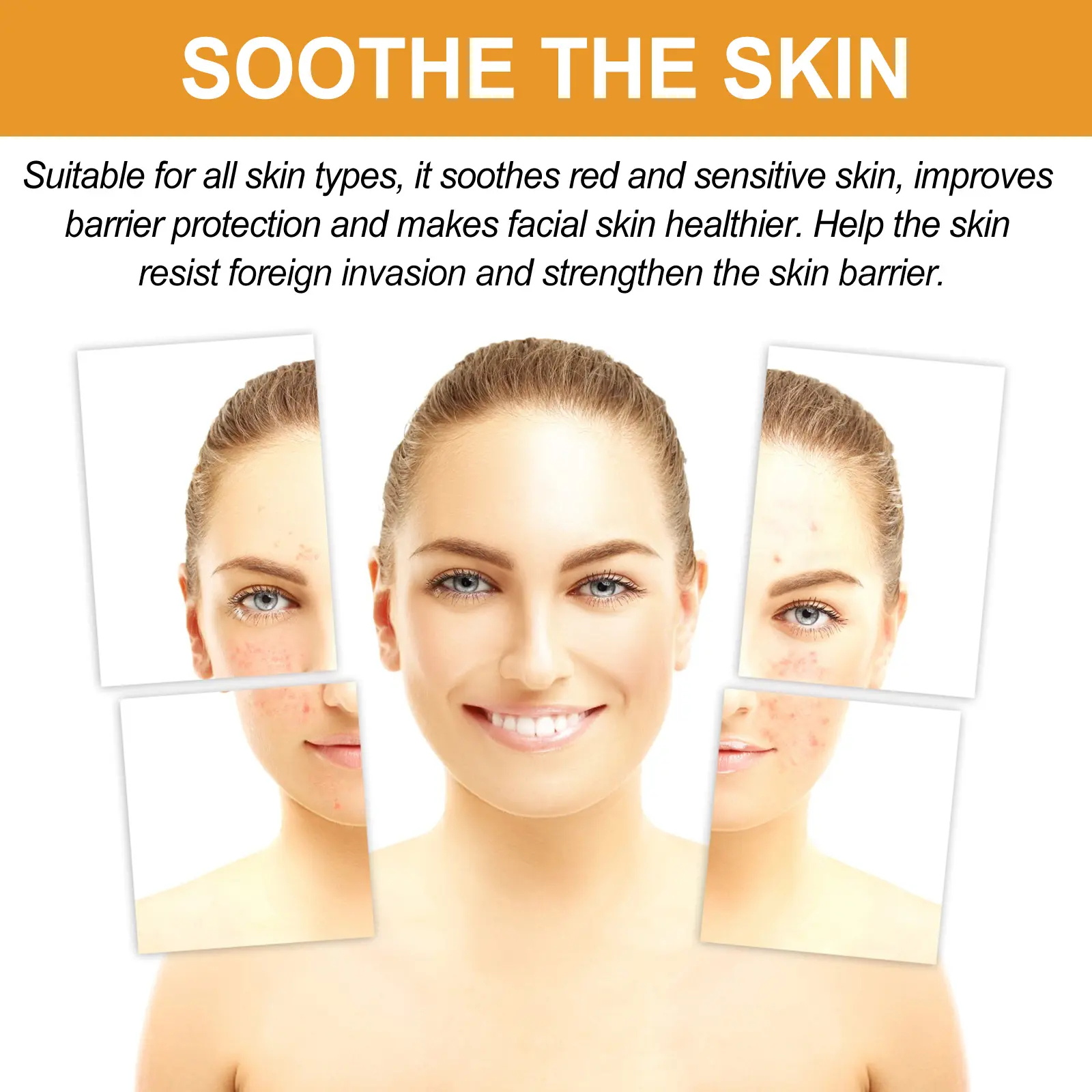 Facial Essence for Acne Marks & Oil Control - West&Month 5 facial essence lighten acne mark oil control West Month 332 5299