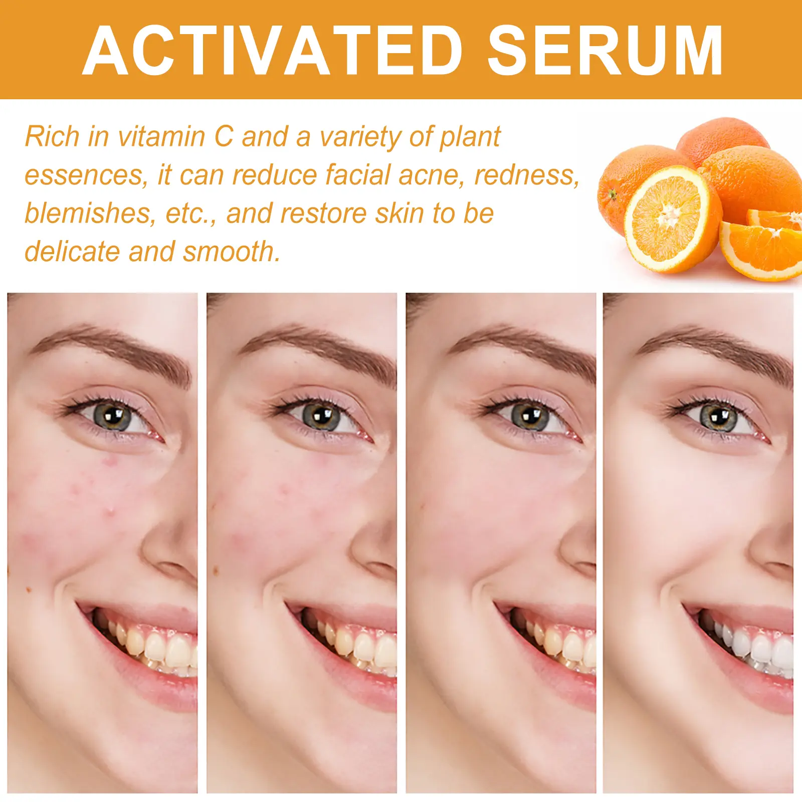 Facial Essence for Acne Marks & Oil Control - West&Month 6 facial essence lighten acne mark oil control West Month 332 5300