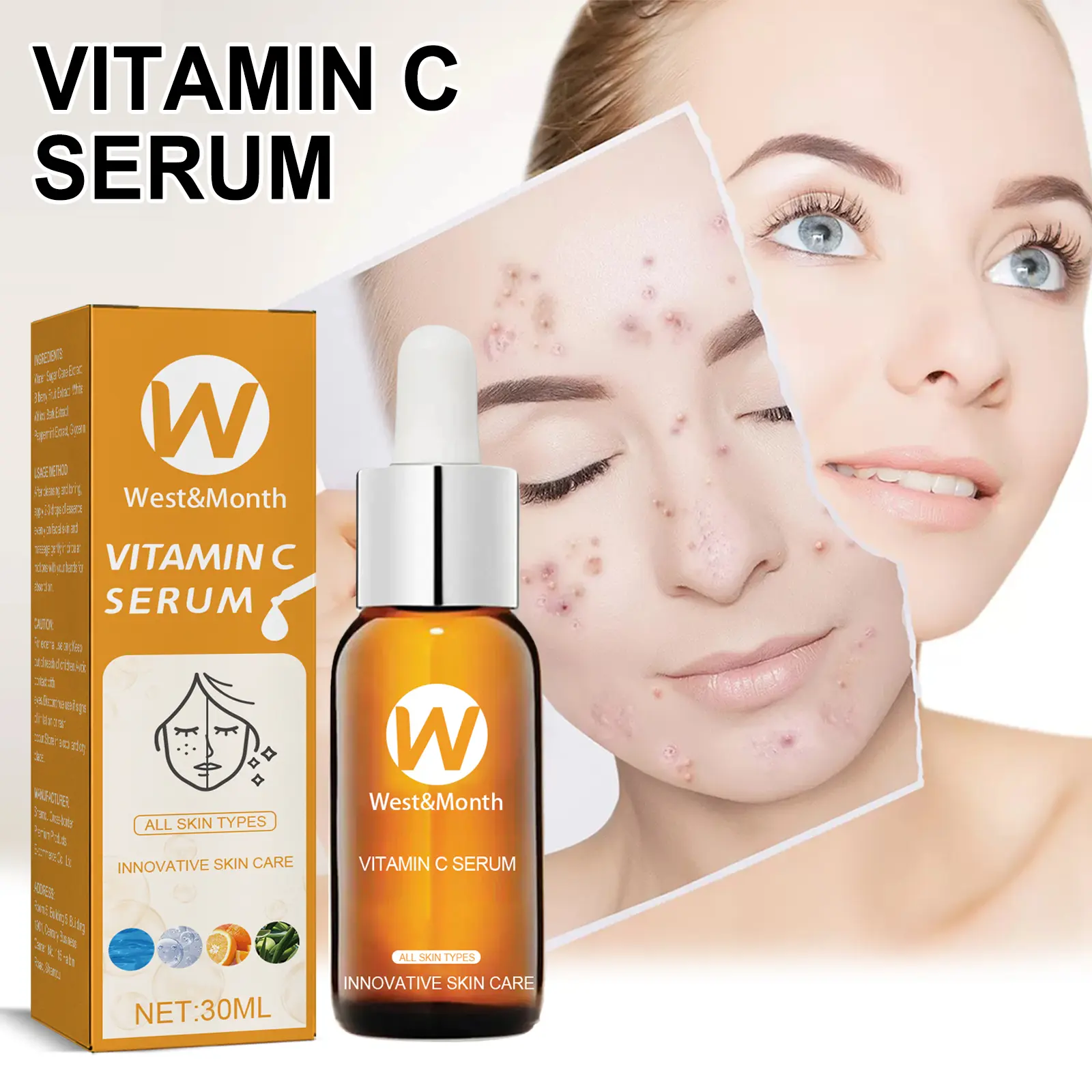 Facial Essence for Acne Marks & Oil Control - West&Month 7 facial essence lighten acne mark oil control West Month 332 5301