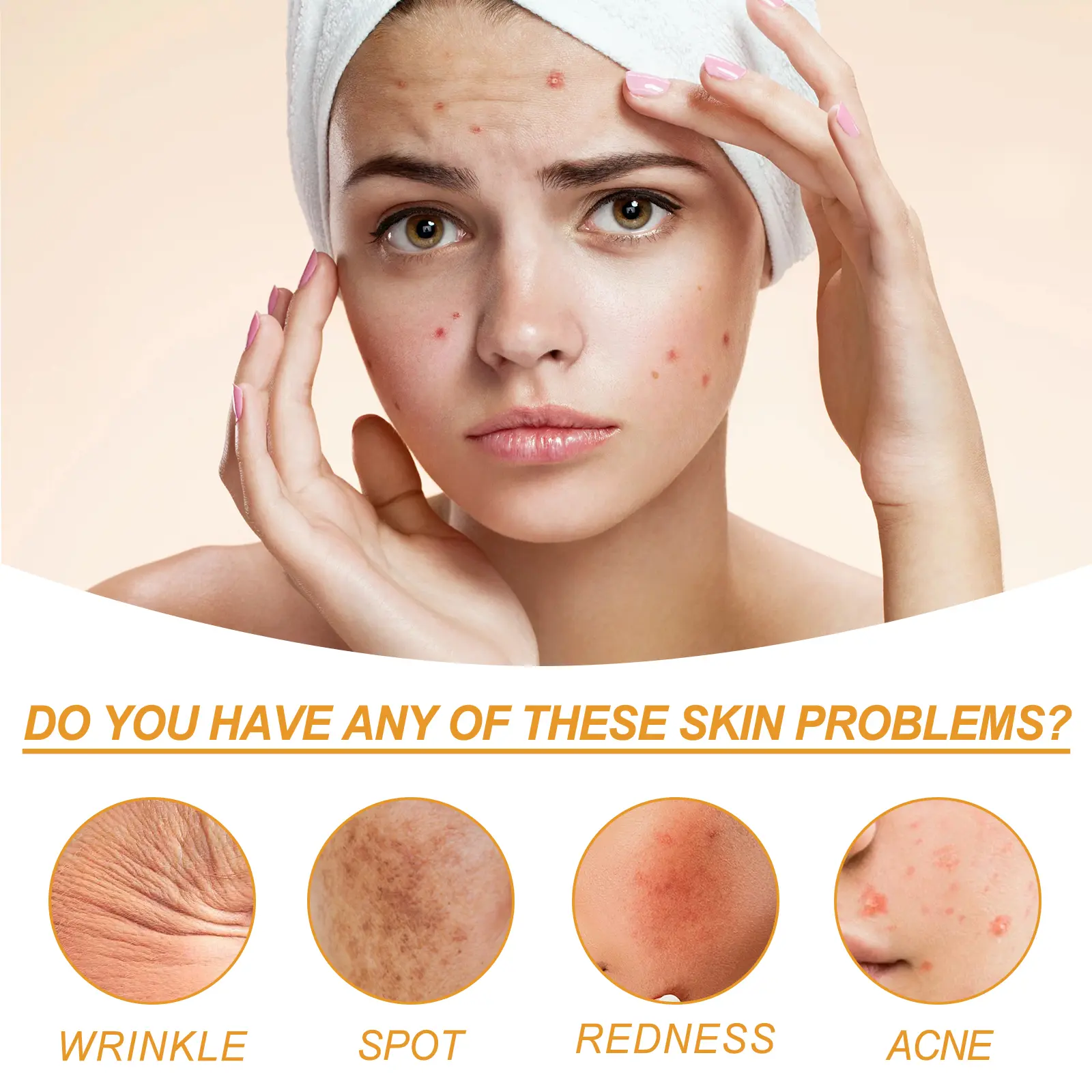 Facial Essence for Acne Marks & Oil Control - West&Month 9 facial essence lighten acne mark oil control West Month 332 5303