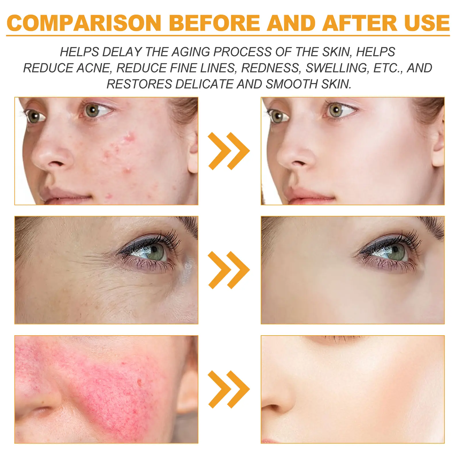 Facial Essence for Acne Marks & Oil Control - West&Month 10 facial essence lighten acne mark oil control West Month 332 5304